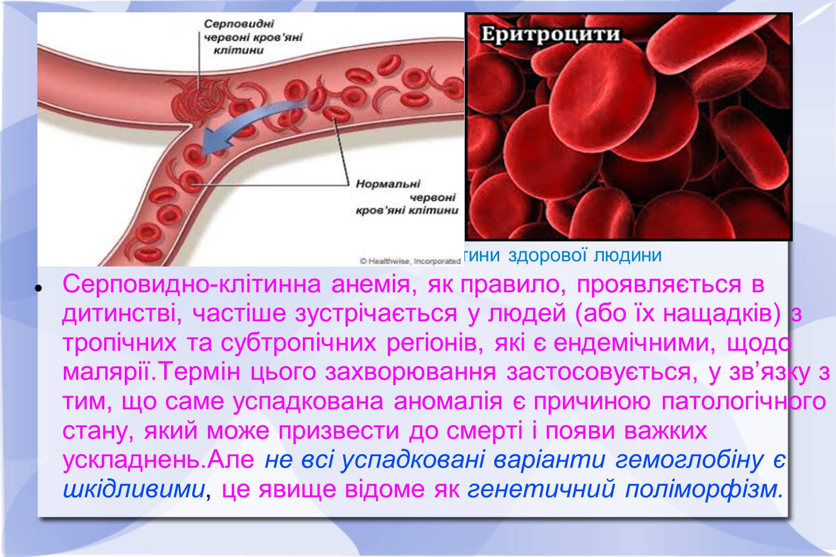 Презентація на тему «Серповидно-клітинна анемія» - Слайд #9