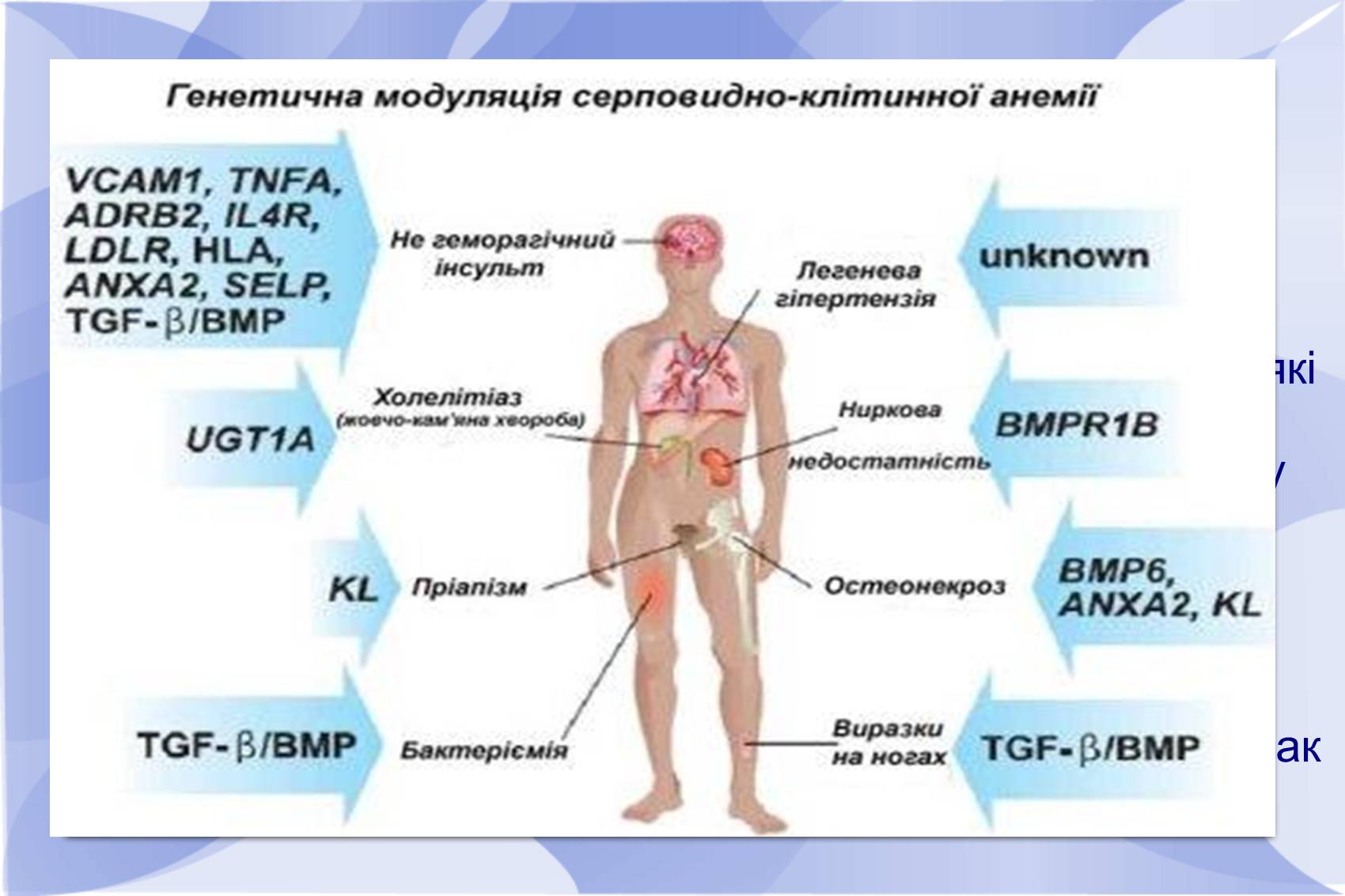 Презентація на тему «Серповидно-клітинна анемія» - Слайд #13