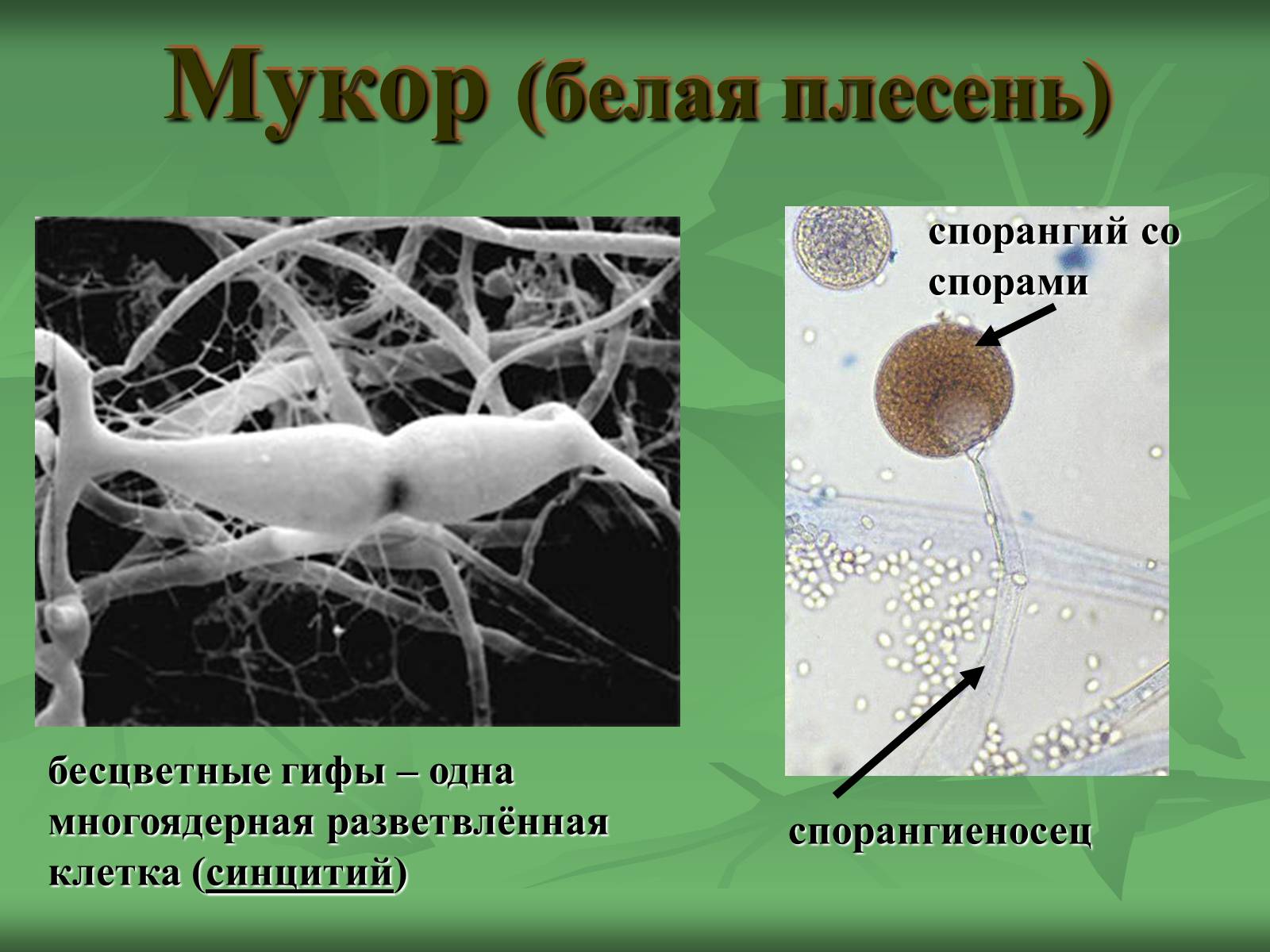 Мукор клетка. Строение гриба мукора. Строение клетки гриба мукора. Строение клетки плесени мукора под микроскопом. Плесень мукор строение клетки.