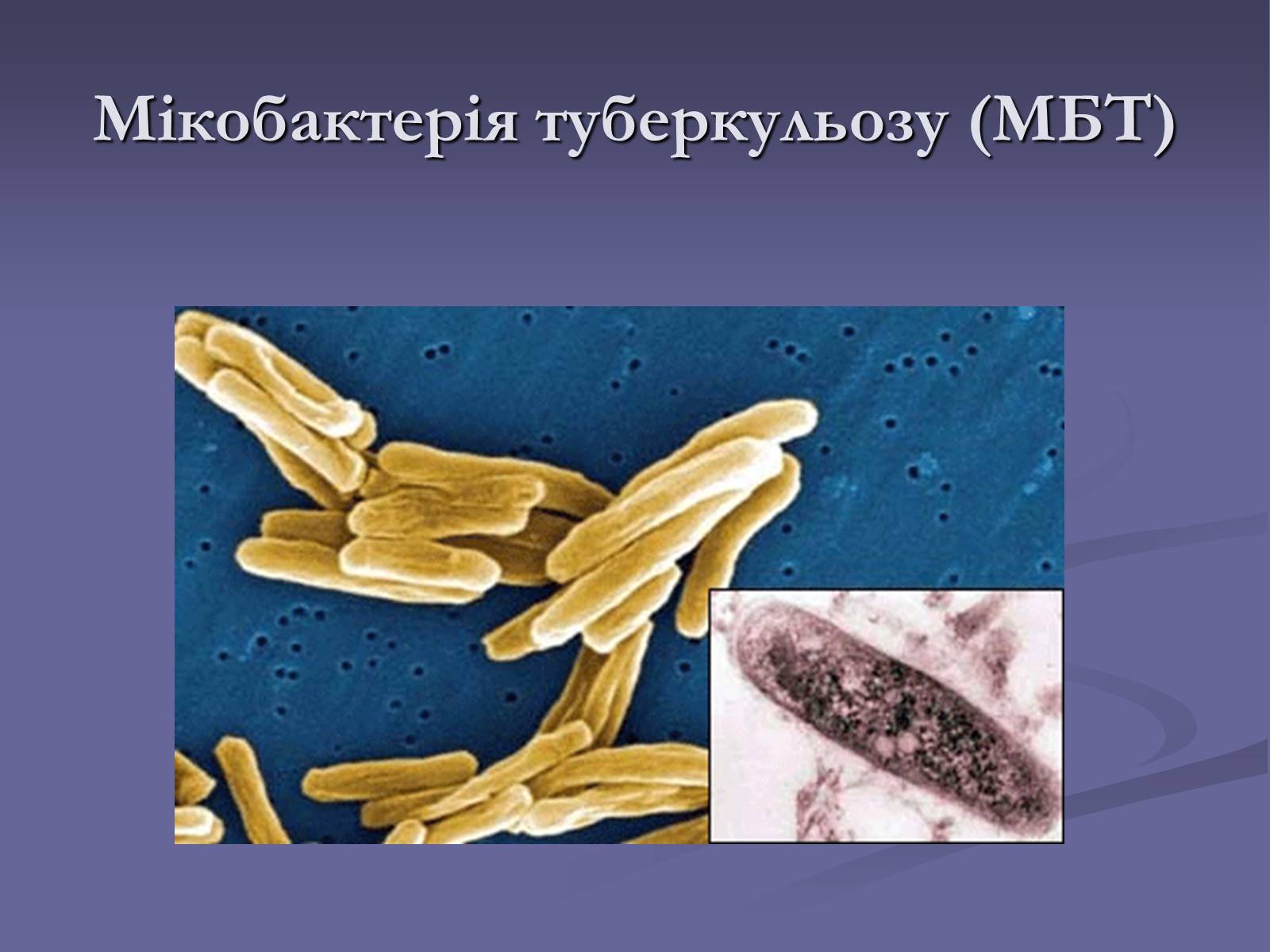 Презентація на тему «Мікобактерія туберкульозу» - Слайд #1