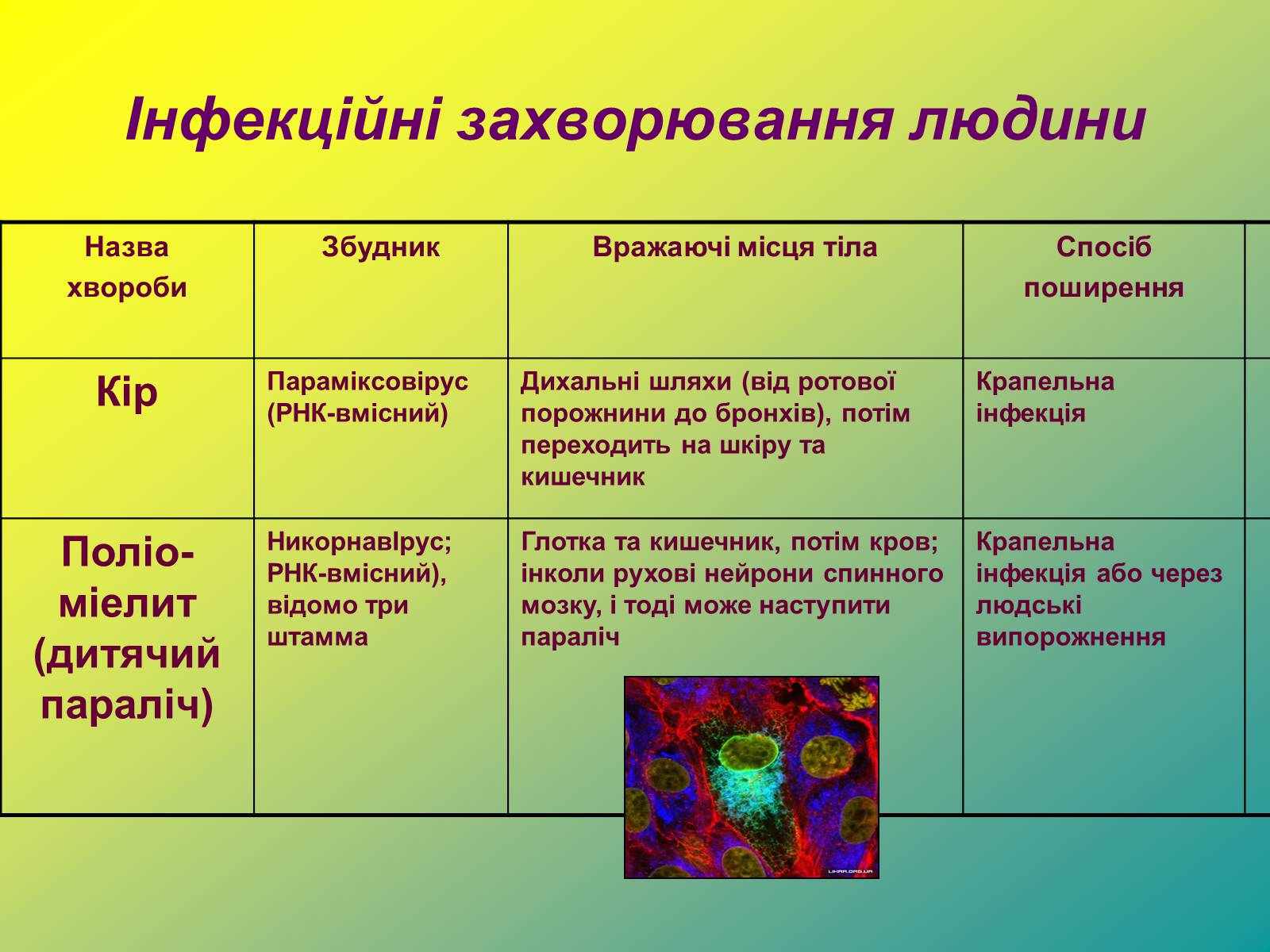 Презентація на тему «Віруси» (варіант 1) - Слайд #20