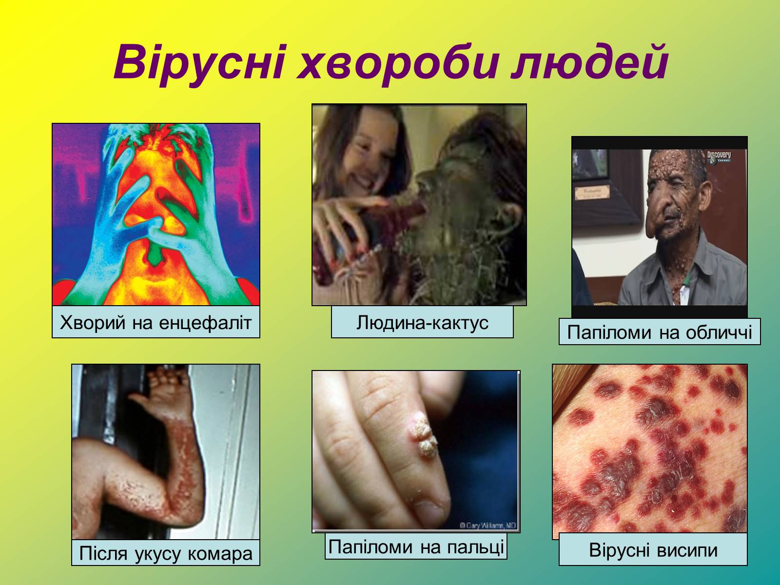 Презентація на тему «Віруси» (варіант 1) - Слайд #27