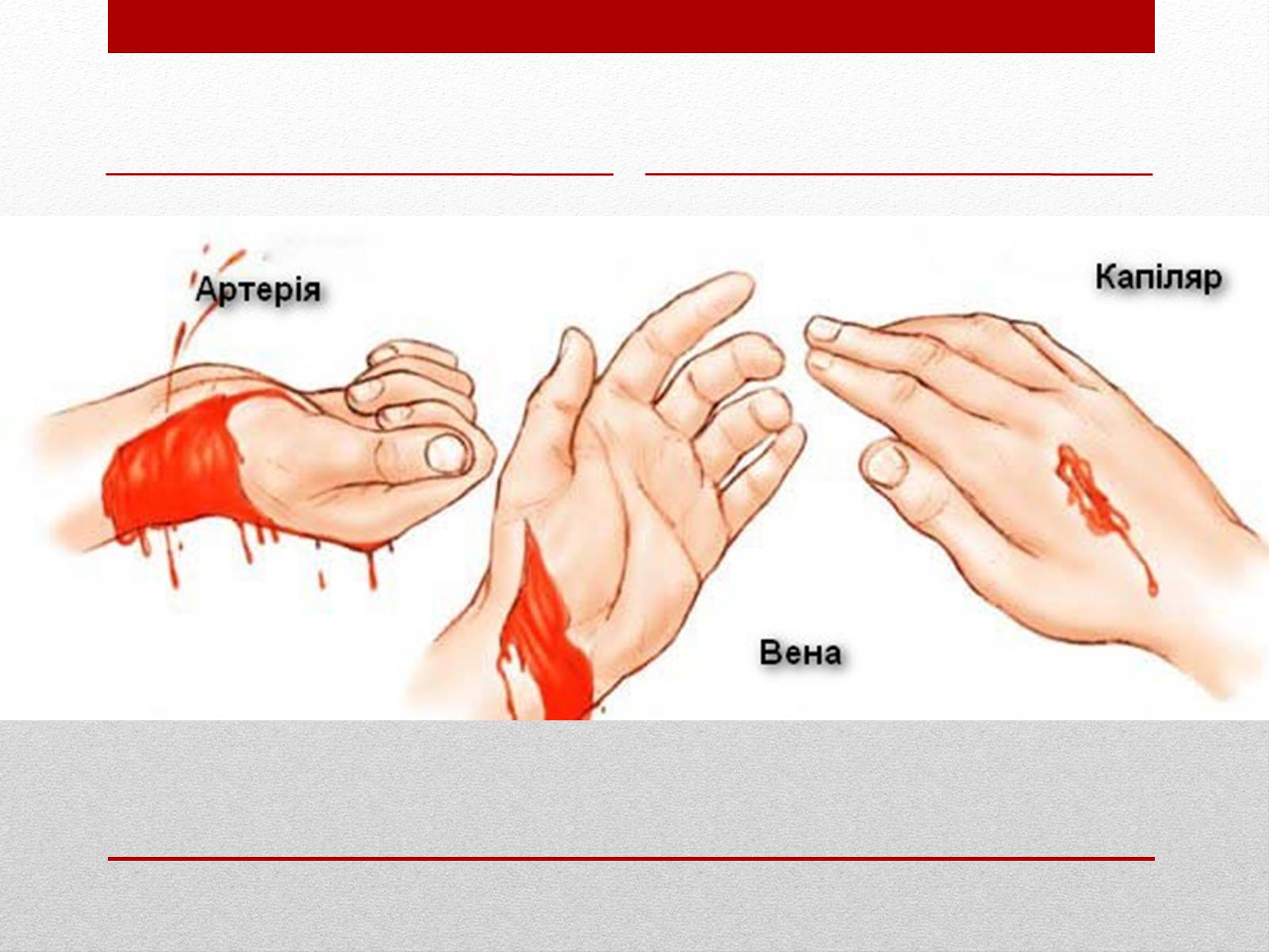 Презентація на тему «Кровотечі» (варіант 2) - Слайд #4