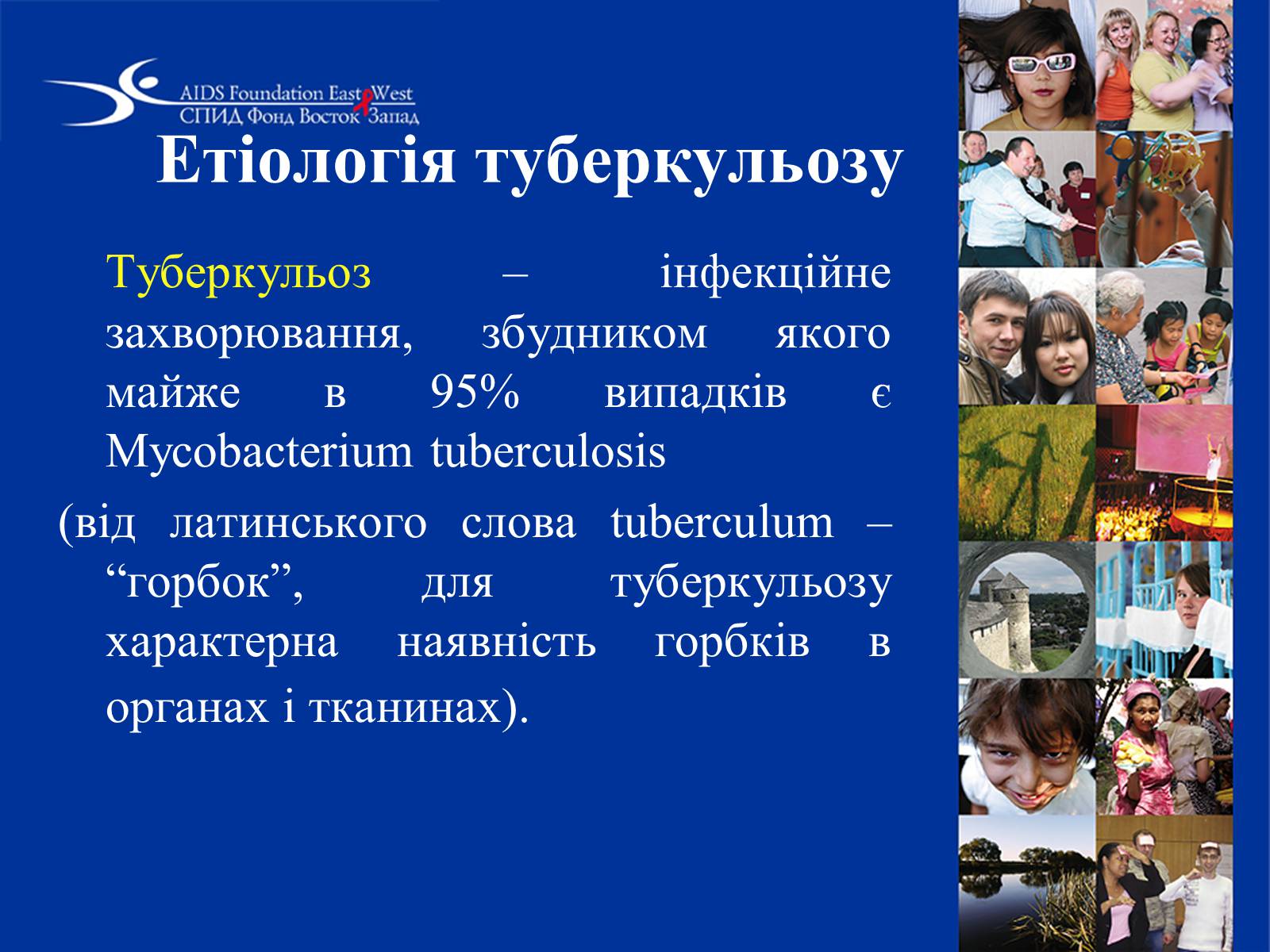 Презентація на тему «Туберкульоз» (варіант 1) - Слайд #4