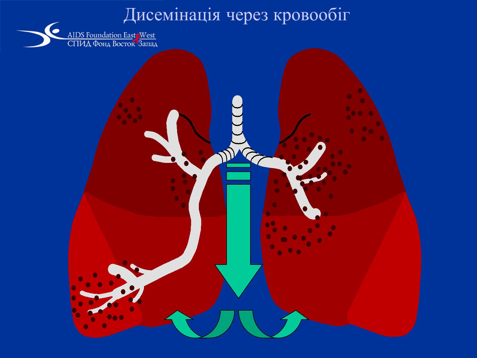 Презентація на тему «Туберкульоз» (варіант 1) - Слайд #23