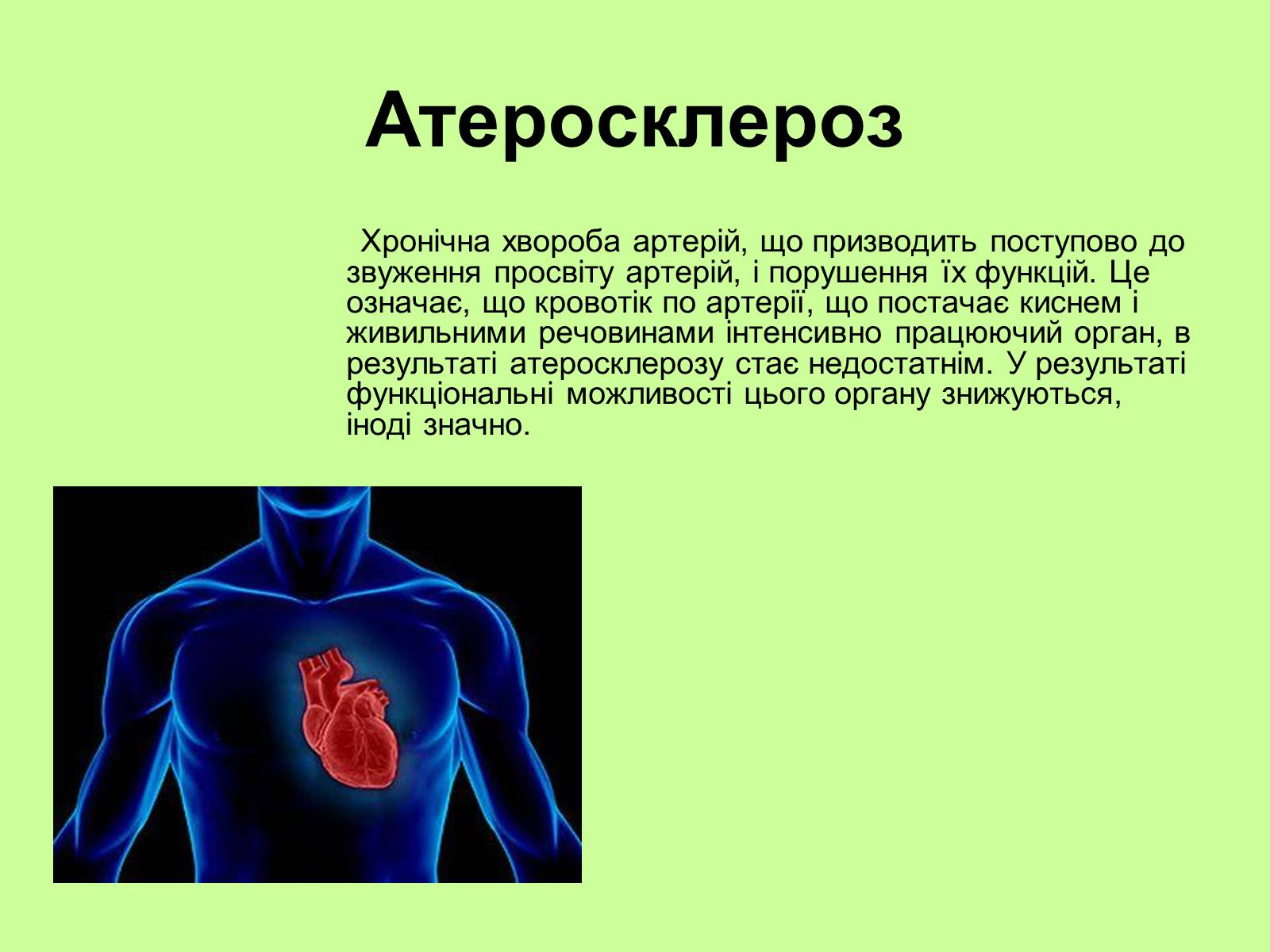 Презентація на тему «Хвороби серцево-судинної системи» (варіант 1) - Слайд #4