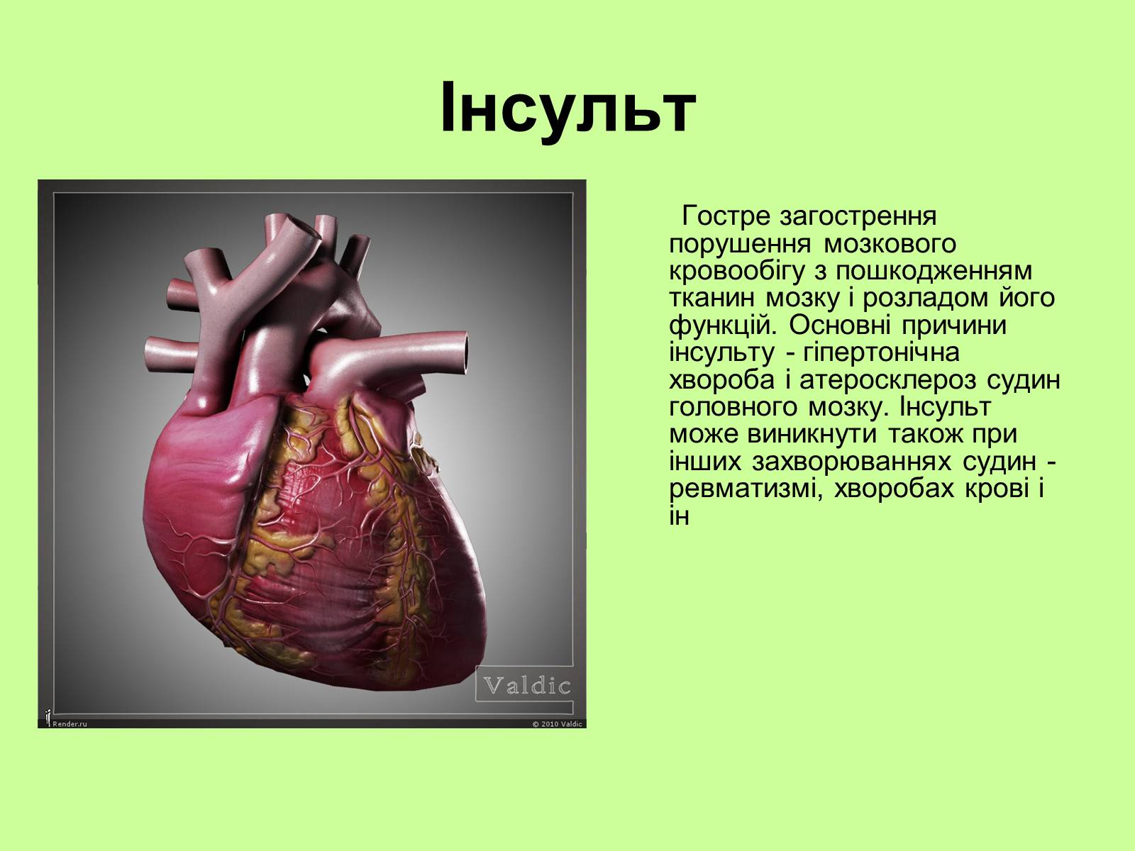 Презентація на тему «Хвороби серцево-судинної системи» (варіант 1) - Слайд #7