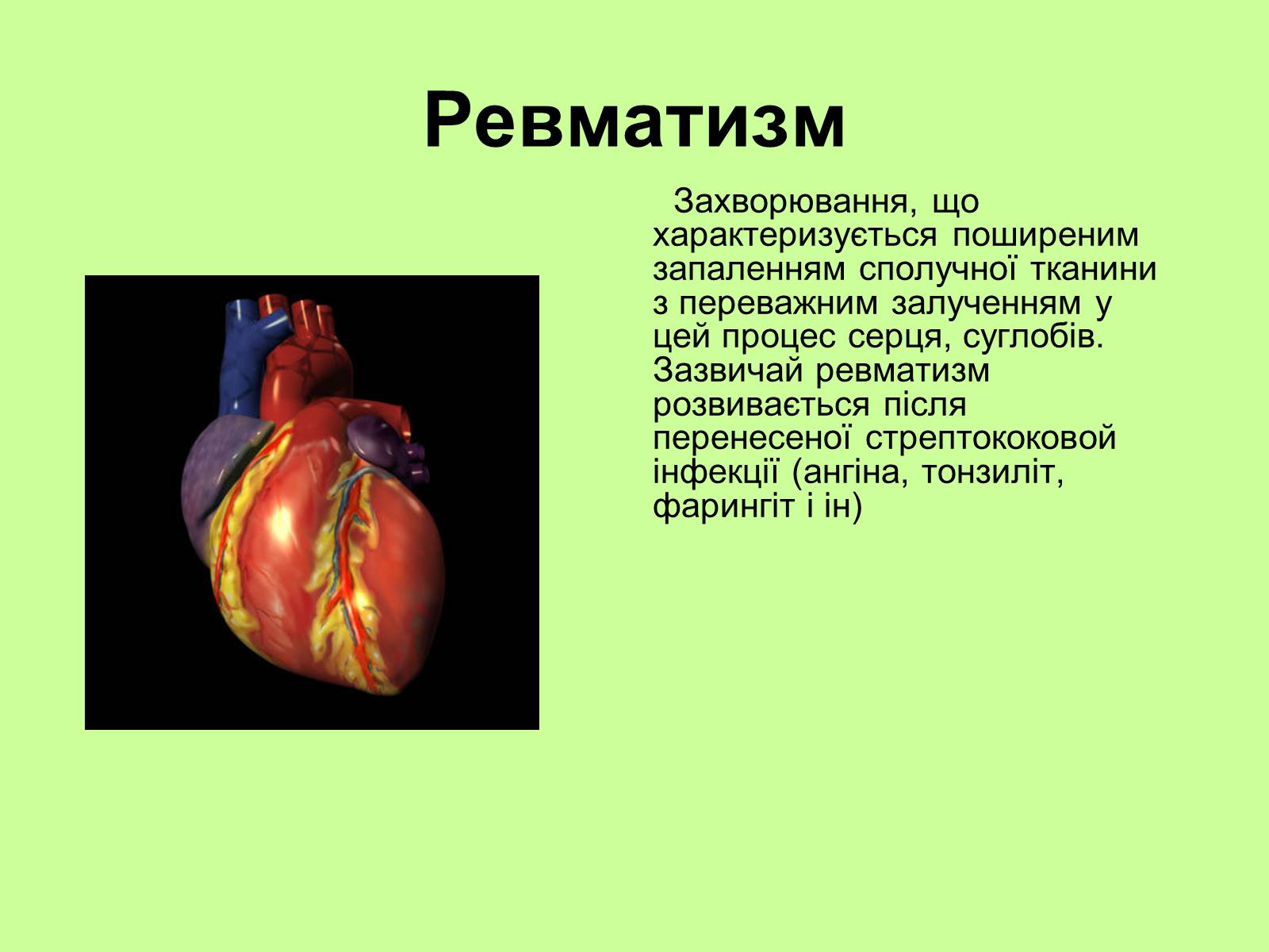 Презентація на тему «Хвороби серцево-судинної системи» (варіант 1) - Слайд #9