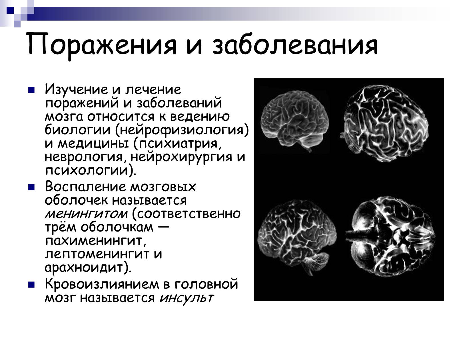 Презентація на тему «Человеский мозг» - Слайд #15