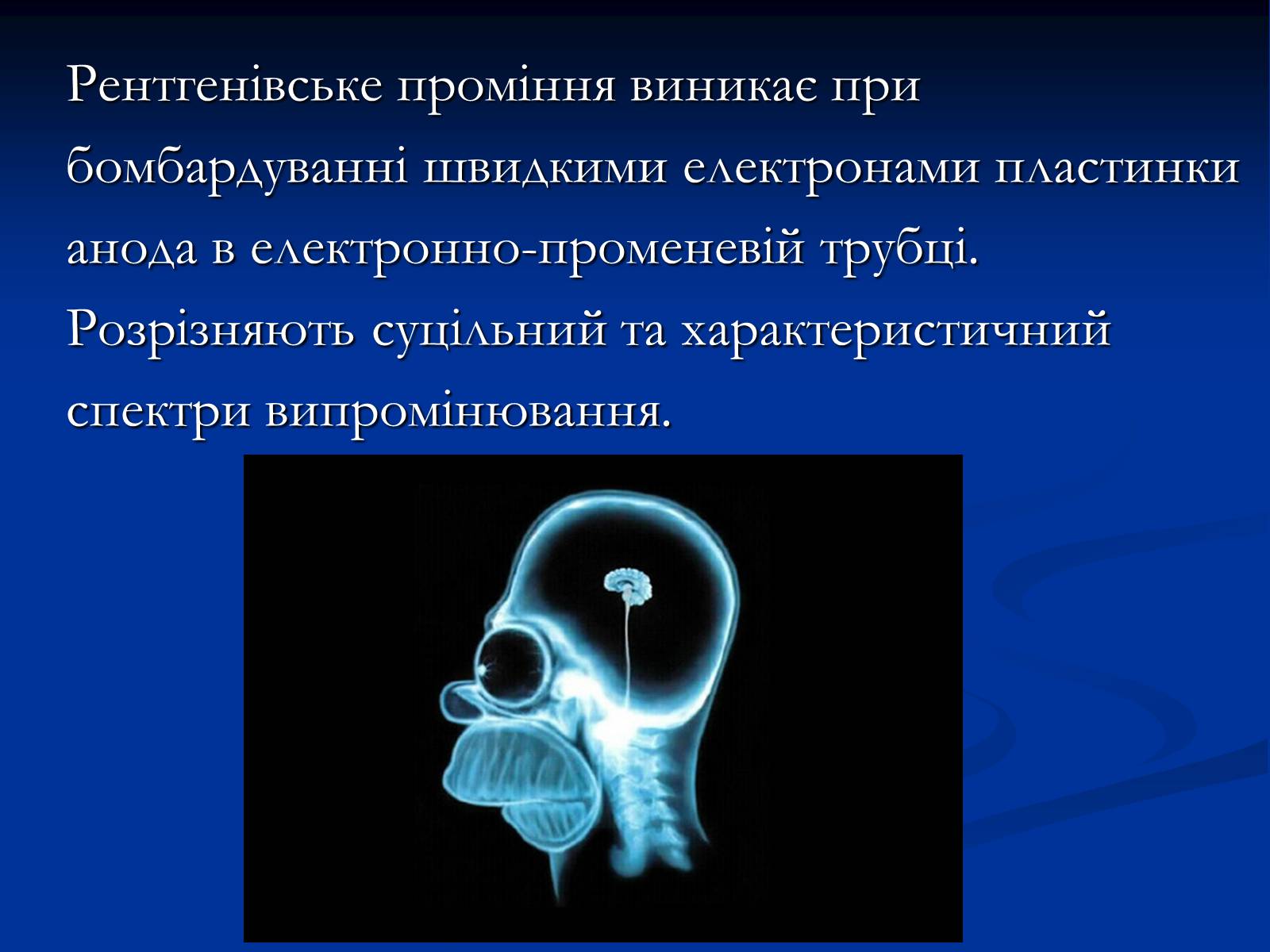 Презентація на тему «Рентгенівське випромінювання» (варіант 10) - Слайд #7
