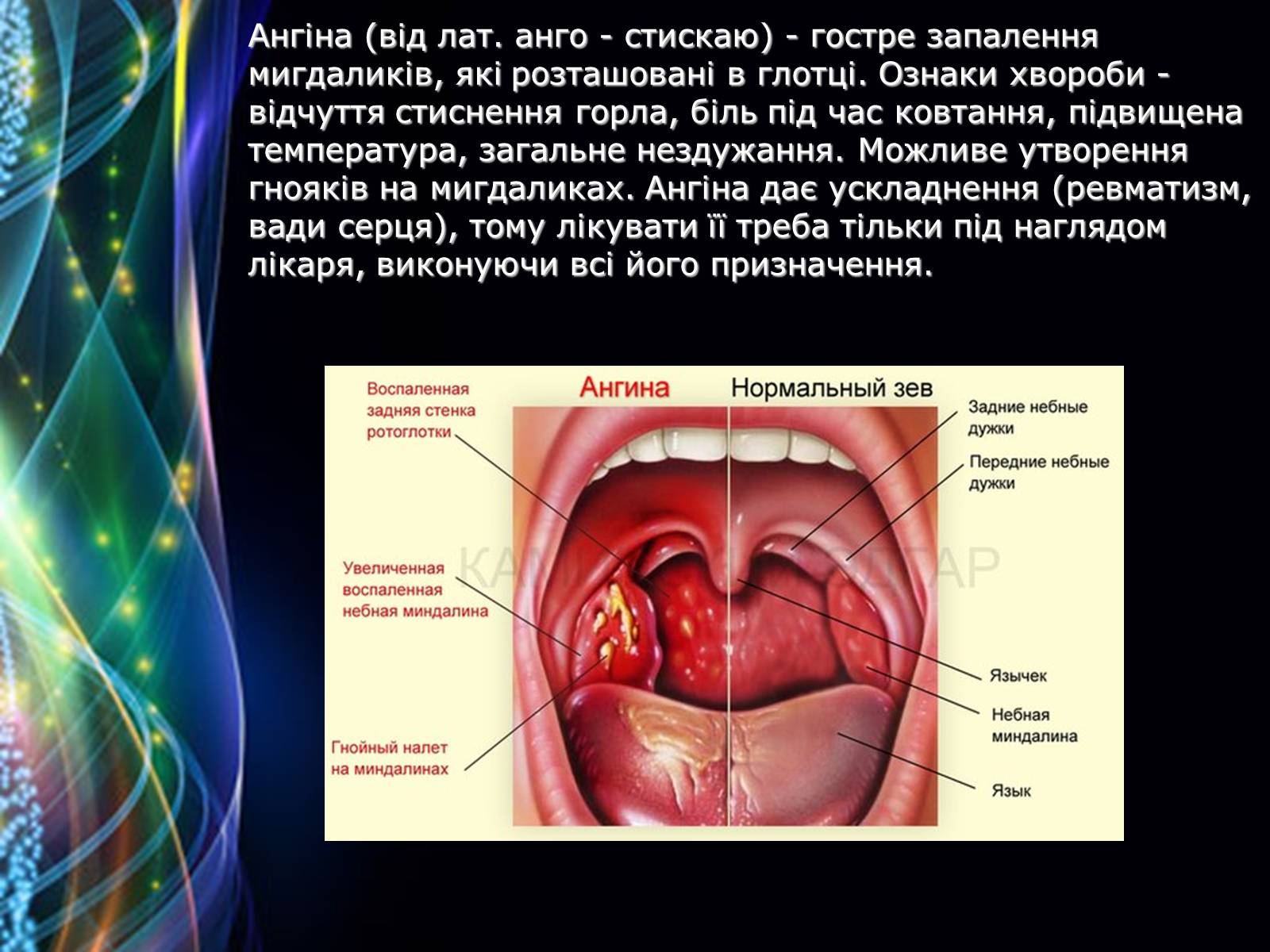 Презентація на тему «Захворювання дихальної системи» (варіант 2) - Слайд #8