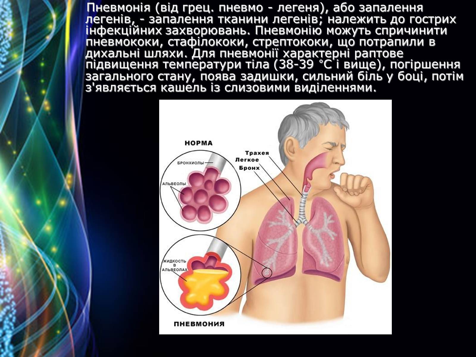 Презентація на тему «Захворювання дихальної системи» (варіант 2) - Слайд #10