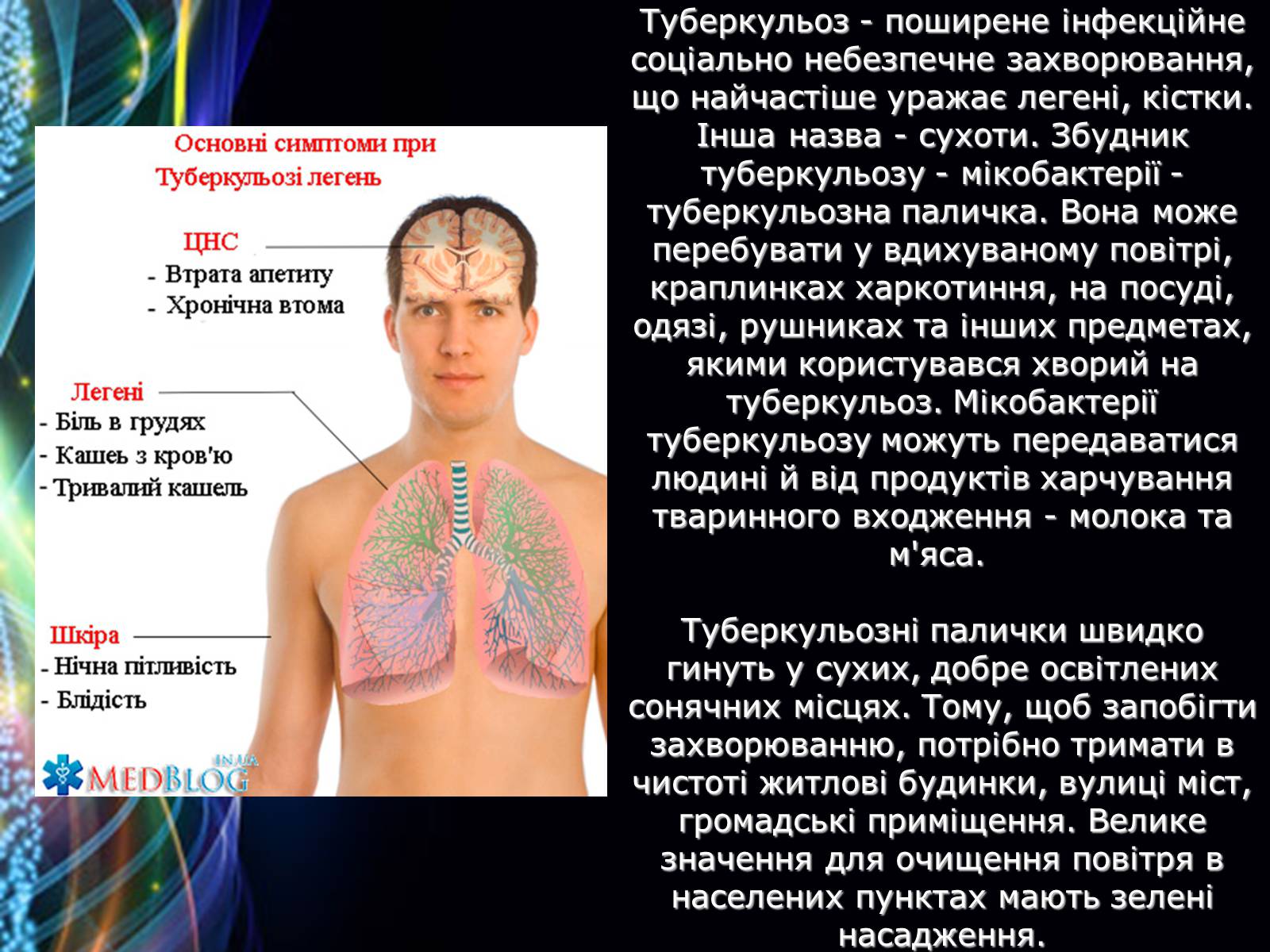 Презентація на тему «Захворювання дихальної системи» (варіант 2) - Слайд #11
