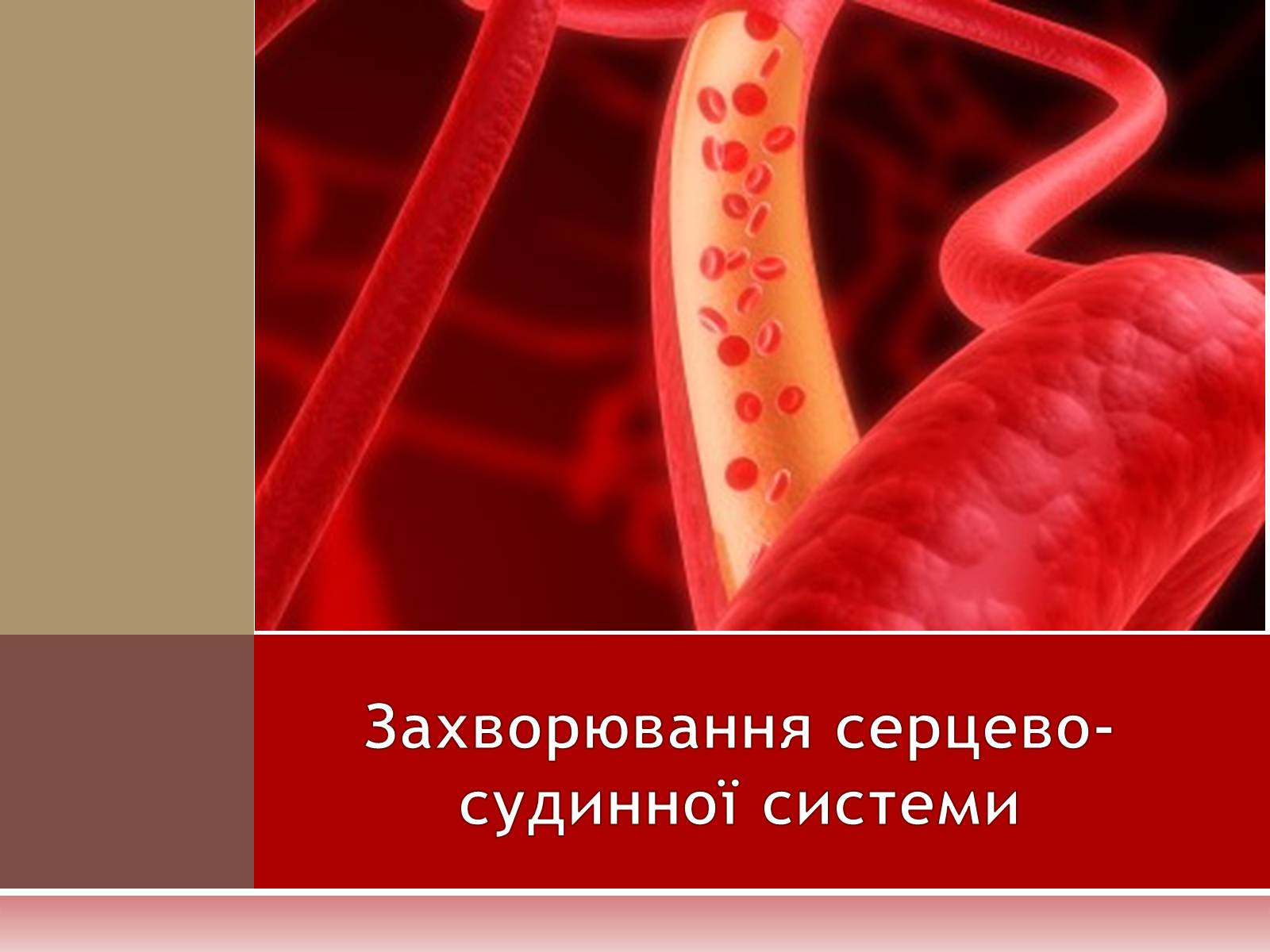Презентація на тему «Захворювання серцево-судинної системи» (варіант 1) - Слайд #1