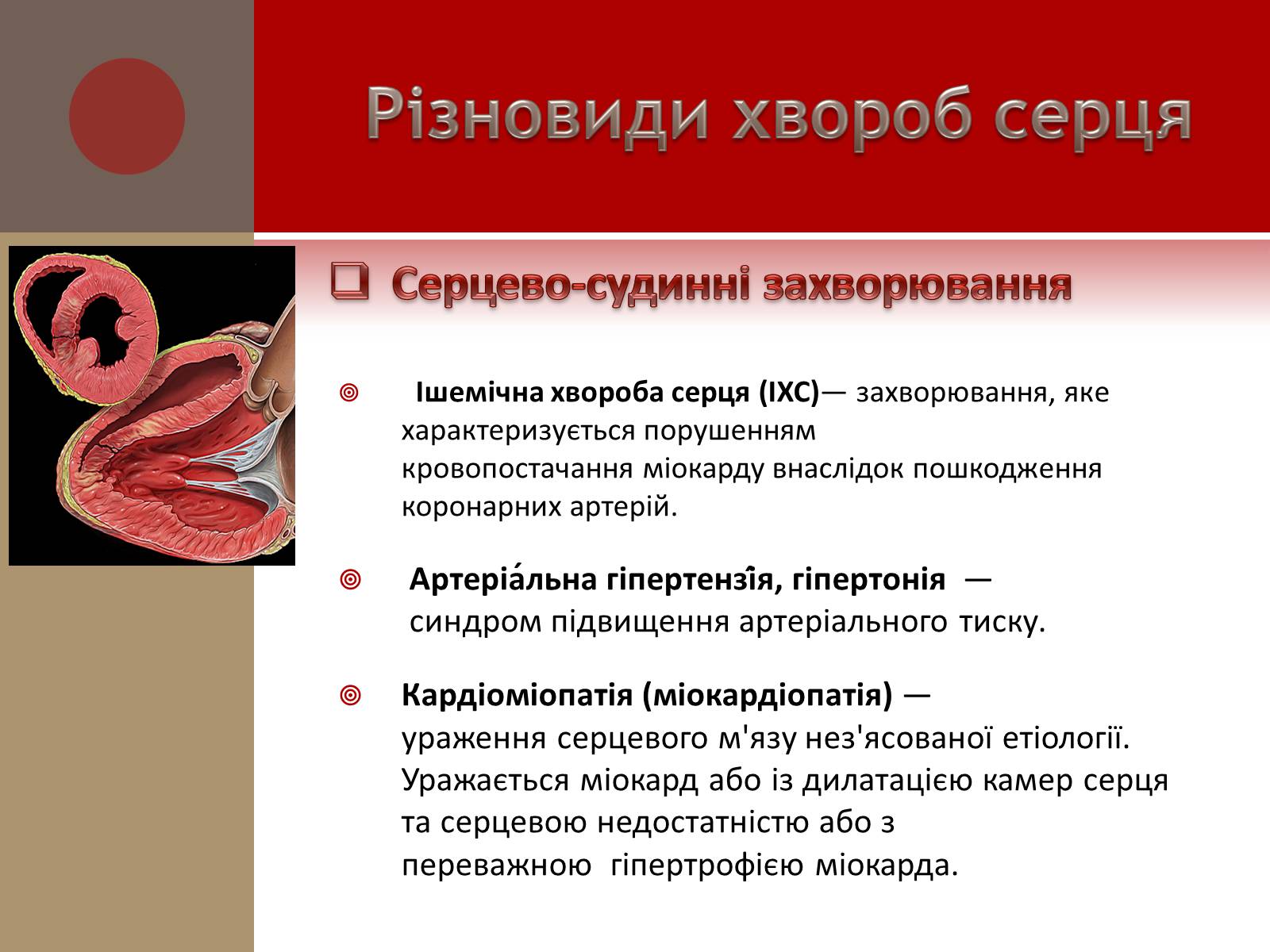 Презентація на тему «Захворювання серцево-судинної системи» (варіант 1) - Слайд #7
