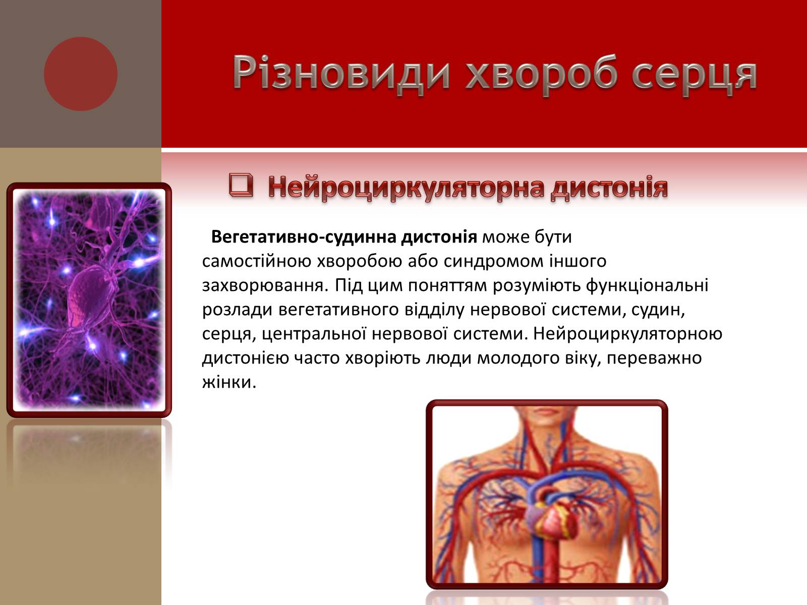 Презентація на тему «Захворювання серцево-судинної системи» (варіант 1) - Слайд #11