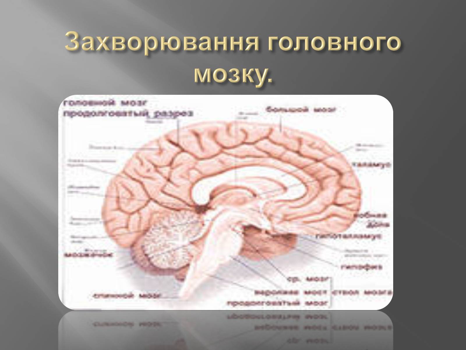 Презентація на тему «Захворювання головного мозку» - Слайд #1