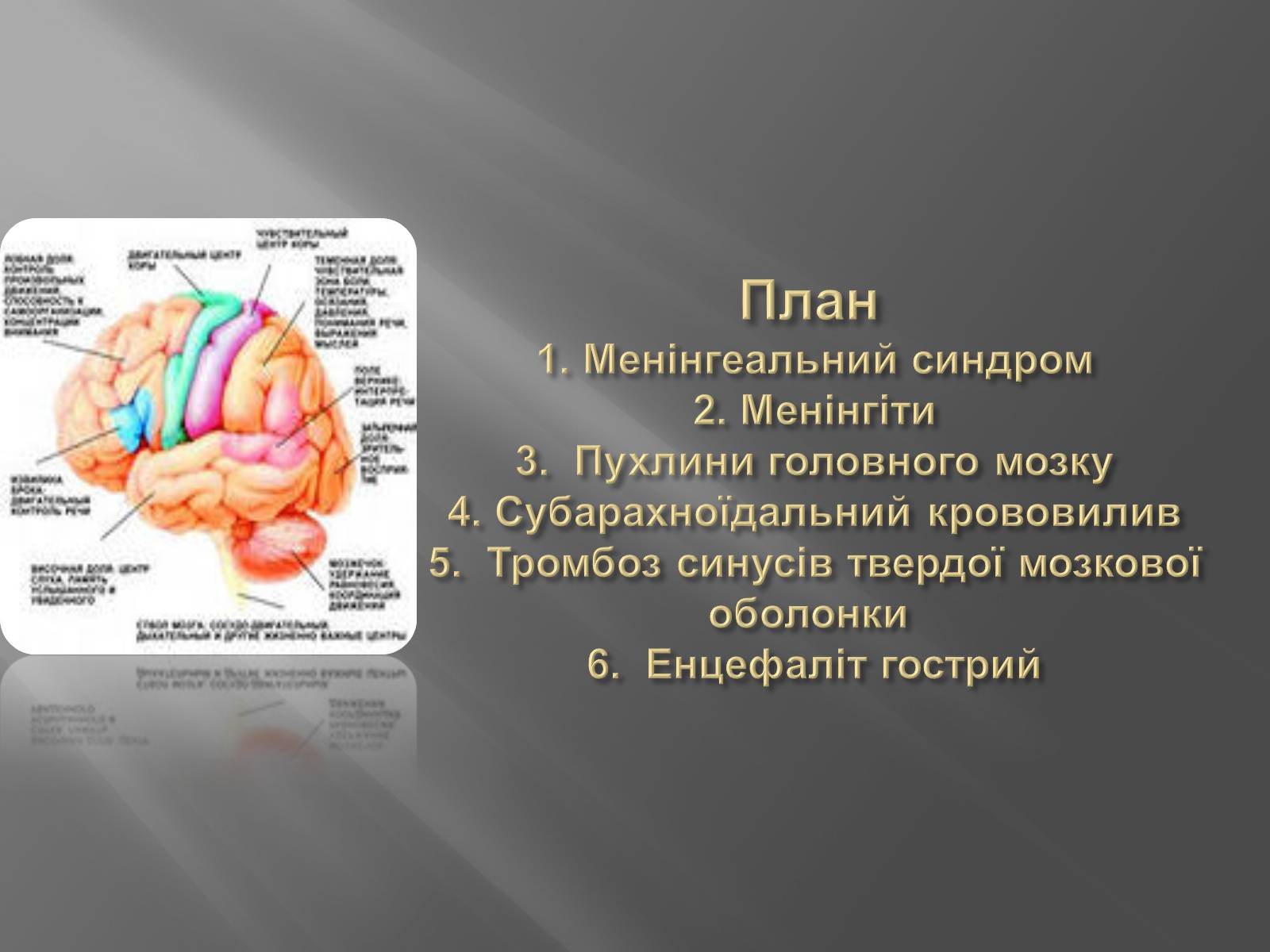 Презентація на тему «Захворювання головного мозку» - Слайд #2