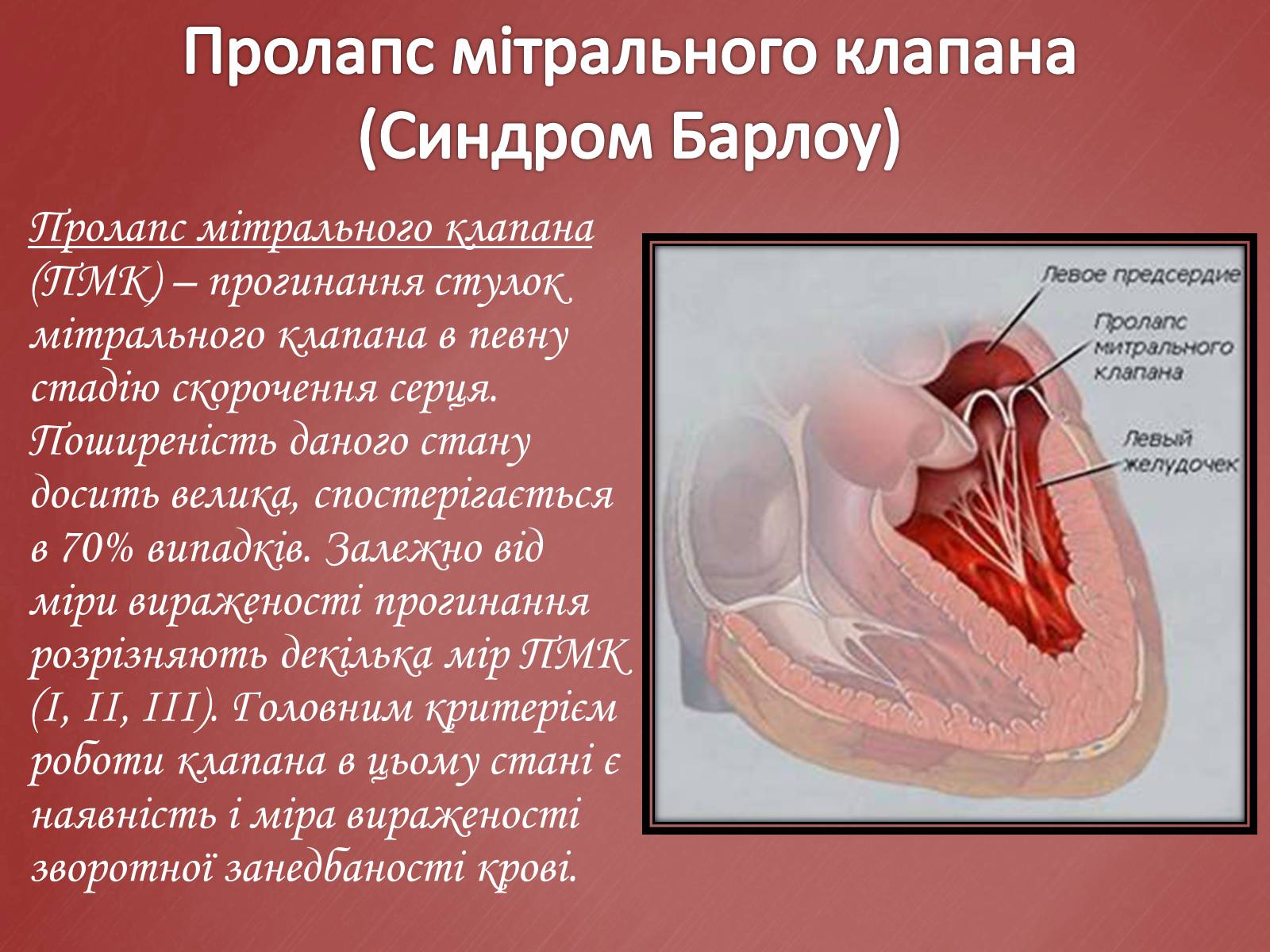Презентація на тему «Захворювання серцево-судинної системи» (варіант 2) - Слайд #8
