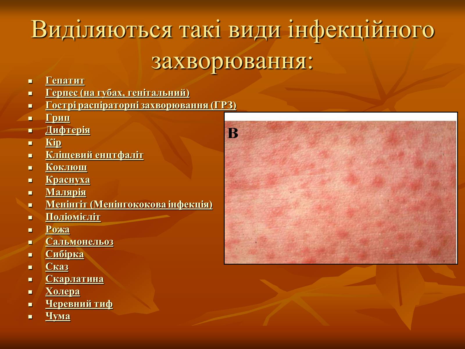 Презентація на тему «Інфекційні захворювання» (варіант 1) - Слайд #9