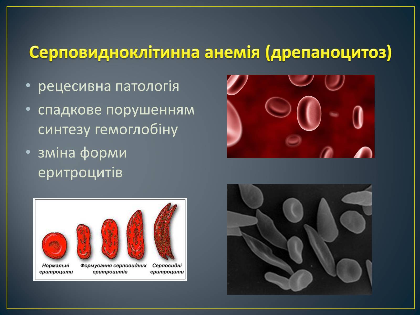 Презентація на тему «Типи генетичних хвороб людини» (варіант 2) - Слайд #4