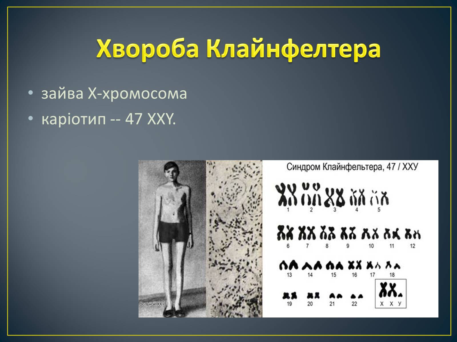 Презентація на тему «Типи генетичних хвороб людини» (варіант 2) - Слайд #19