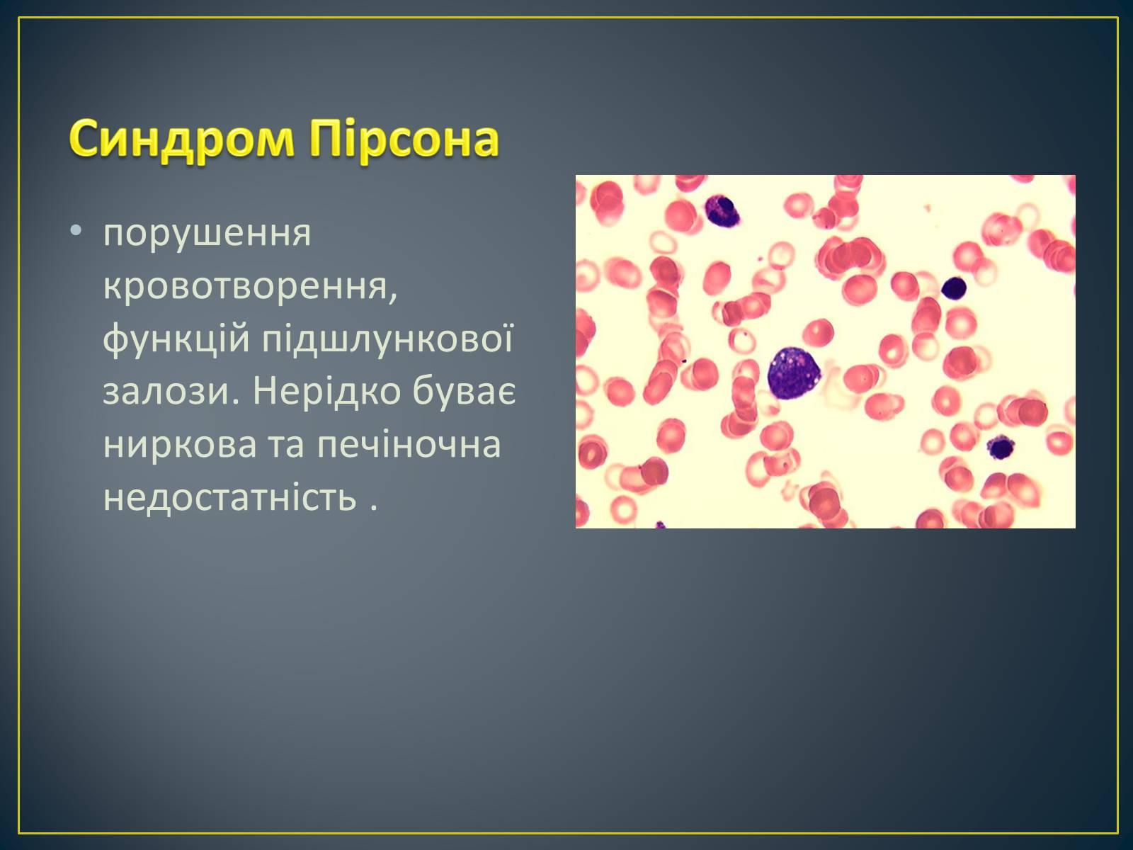 Презентація на тему «Типи генетичних хвороб людини» (варіант 2) - Слайд #22