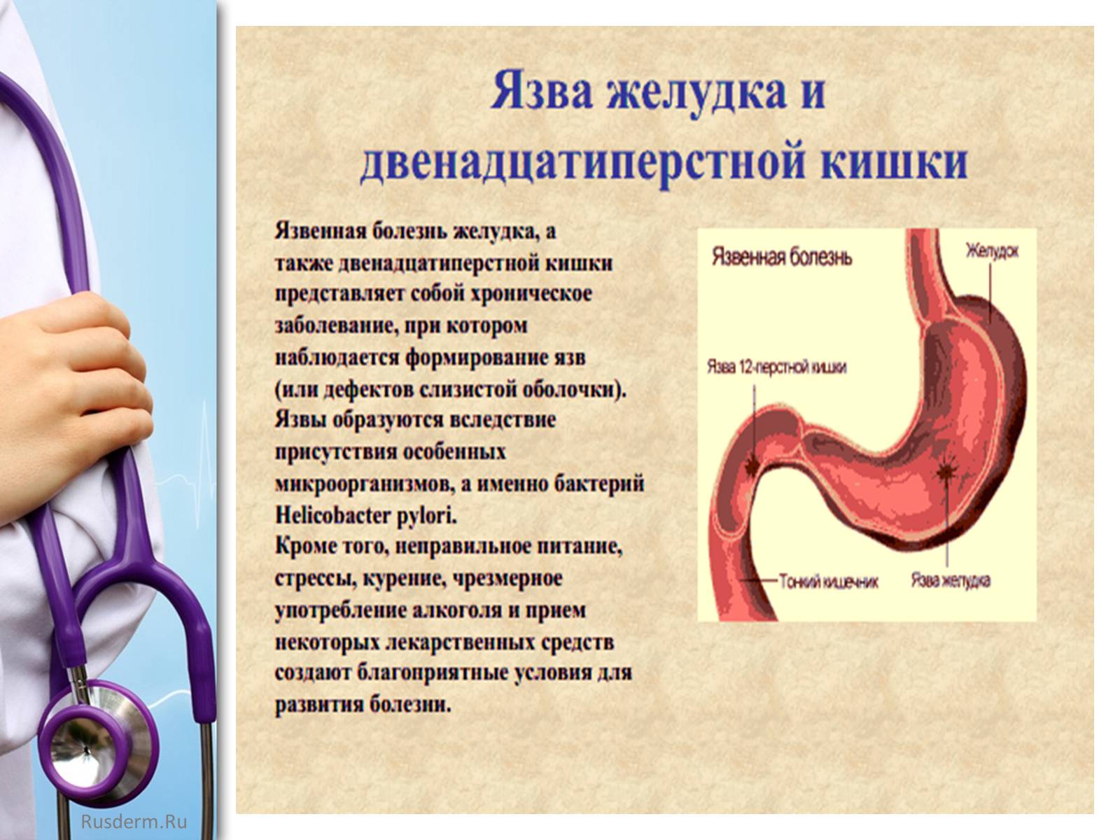 Презентація на тему «Заболевания пищеварительной системы» - Слайд #24