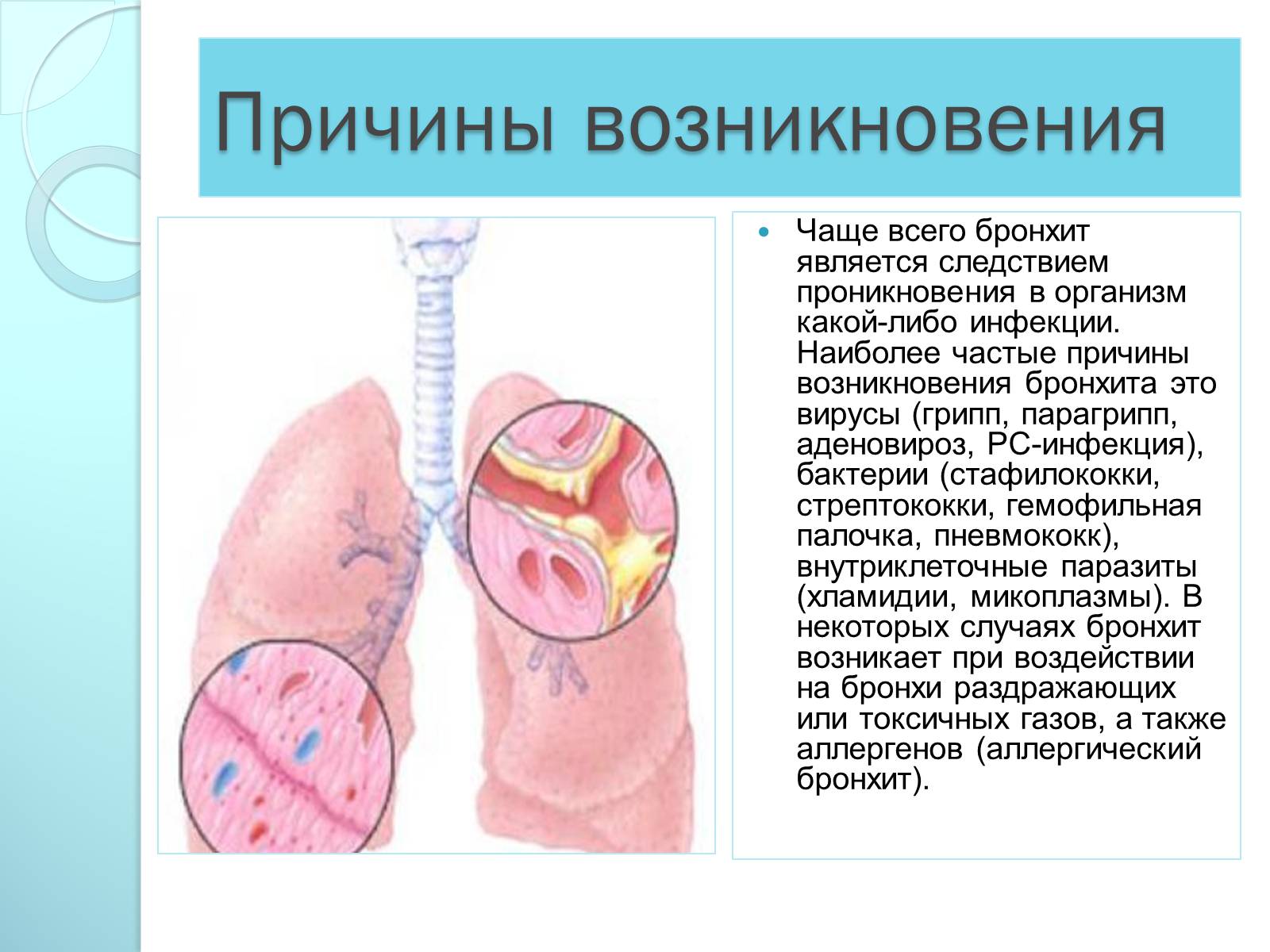 Презентація на тему «Инфекционные болезни дыхательной системы» - Слайд #9