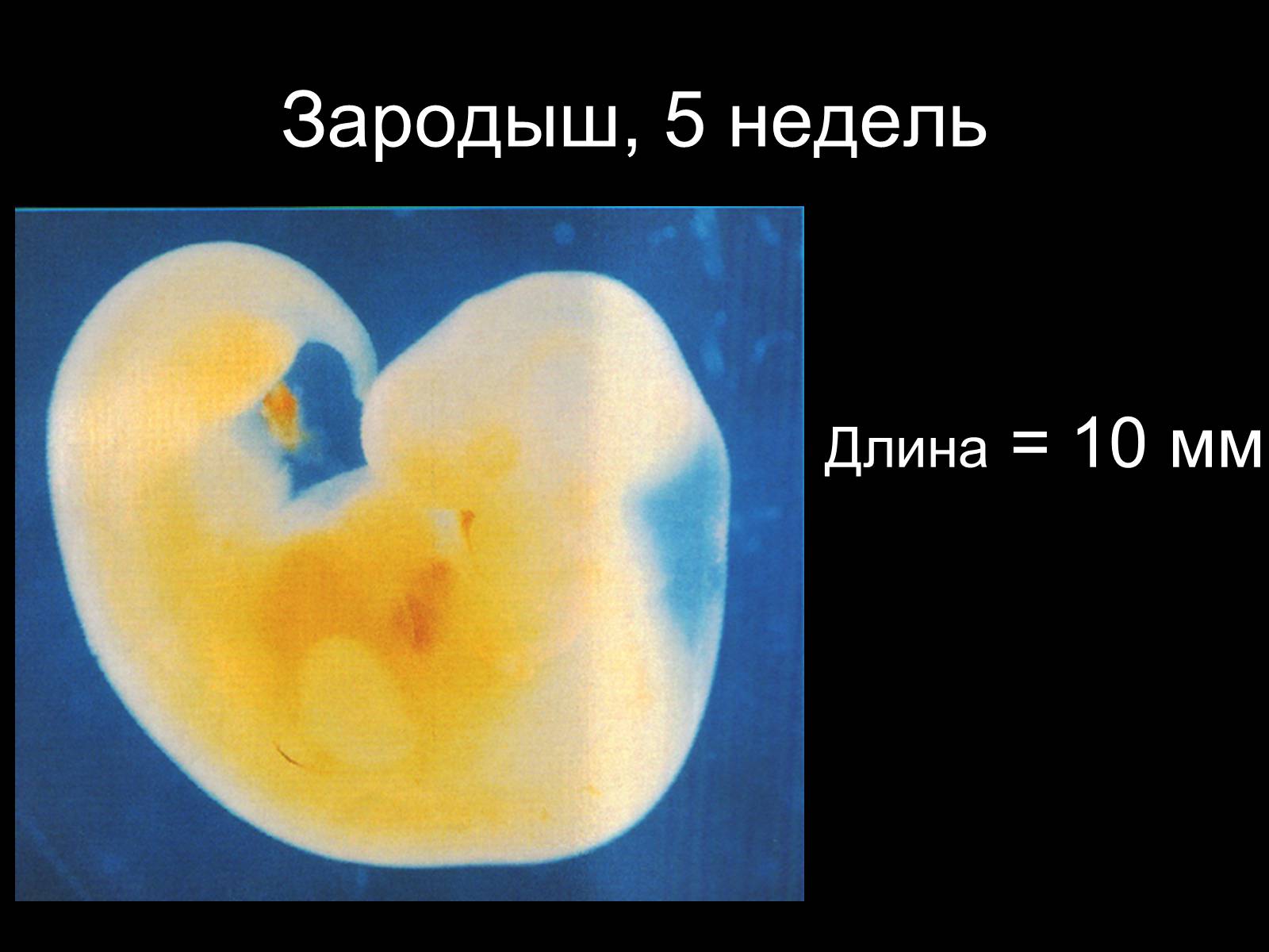 Размер эмбриона на 5 неделе