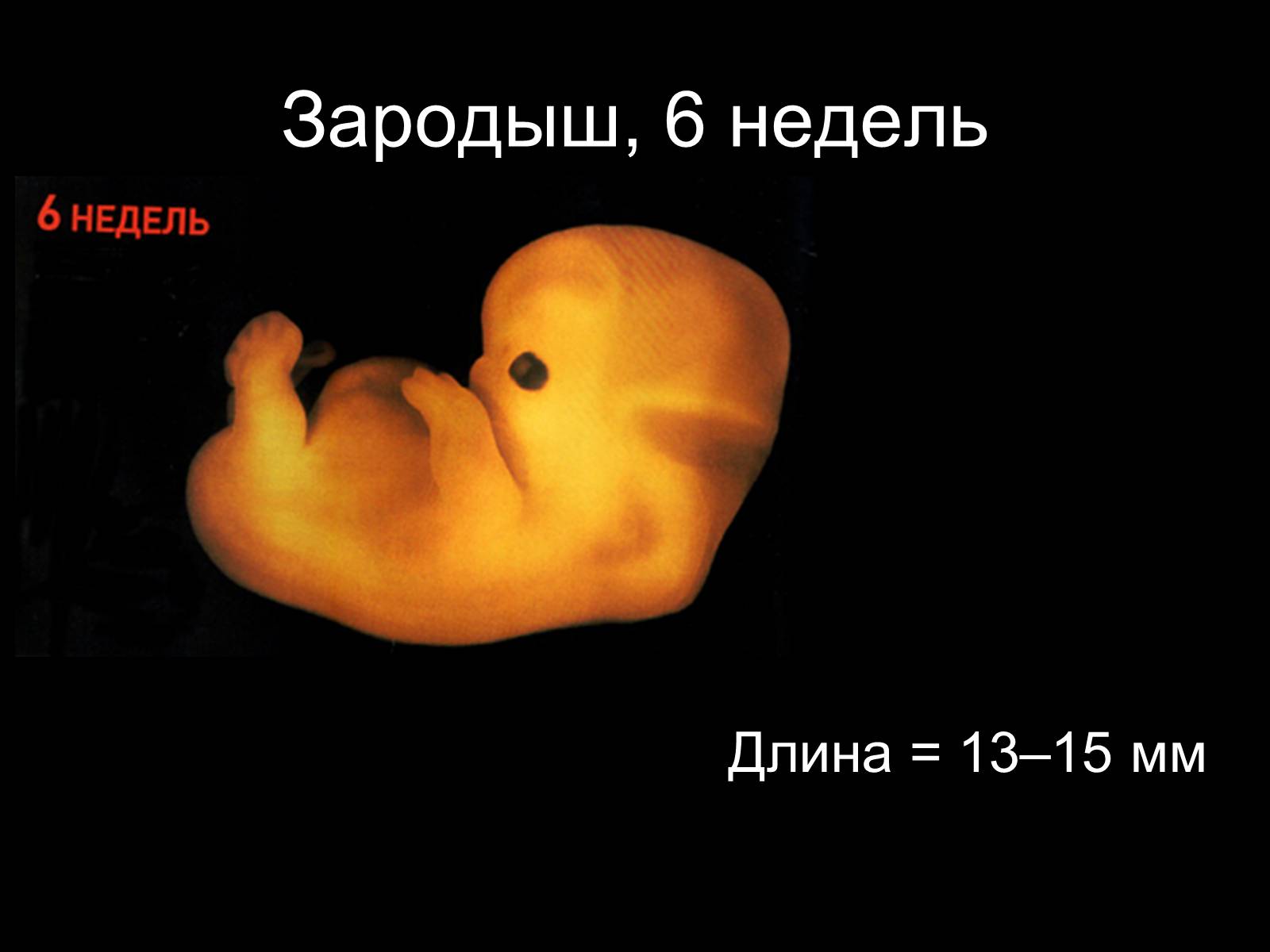 6 недель в россии. Плод 6 недель беременности размер плода. Как выглядит зародыш в 6 недель. Зародыш 6 недель размер плода. Размер эмбриона на 6 неделе.