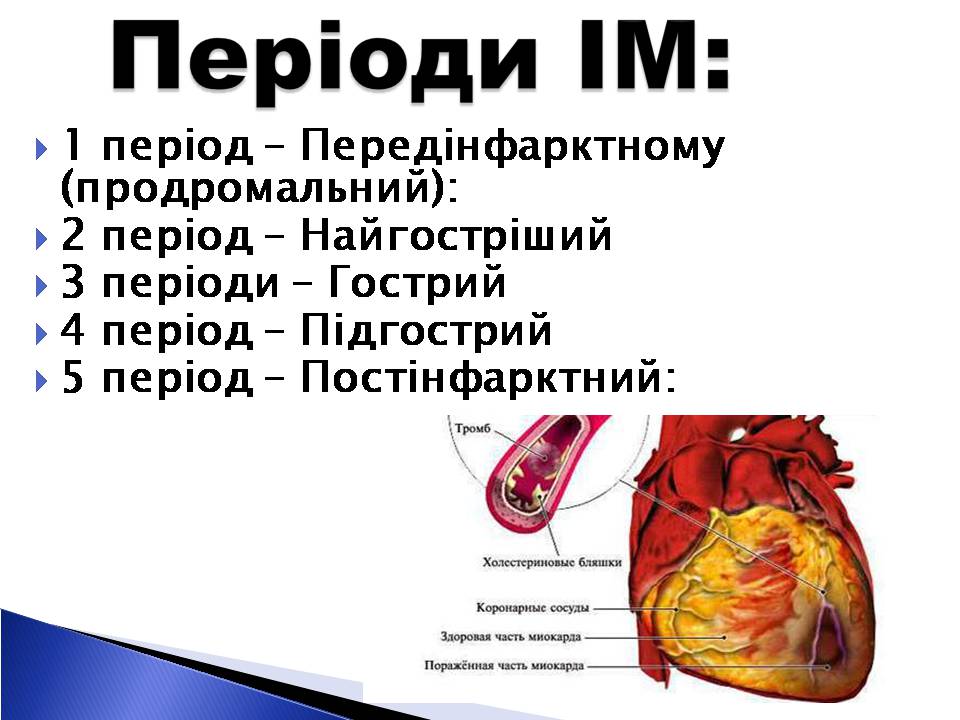 Презентація на тему «Інфаркт міокарда» (варіант 2) - Слайд #4