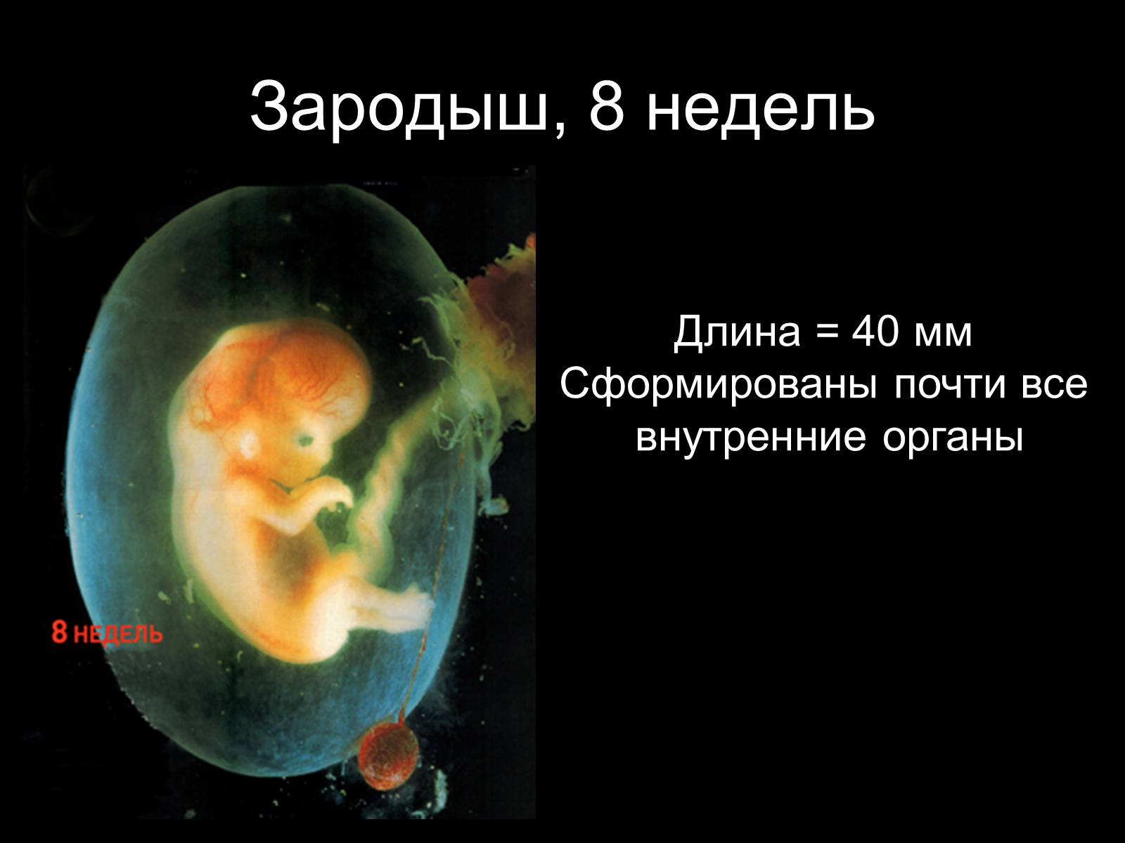 8 недель и 4 дня. Размер зародыша на 8 неделе беременности. Эмбрион ребенка в 8 недель беременности. Восемь недель беременности размер плода. Как выглядит ребёнок эмбрион в 8недель.