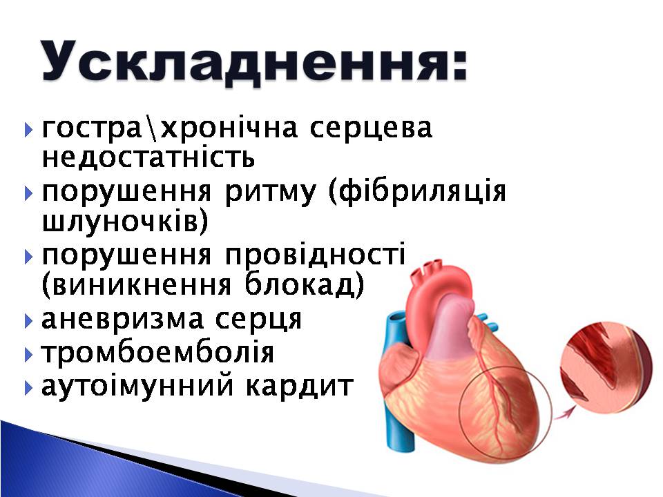 Презентація на тему «Інфаркт міокарда» (варіант 2) - Слайд #5