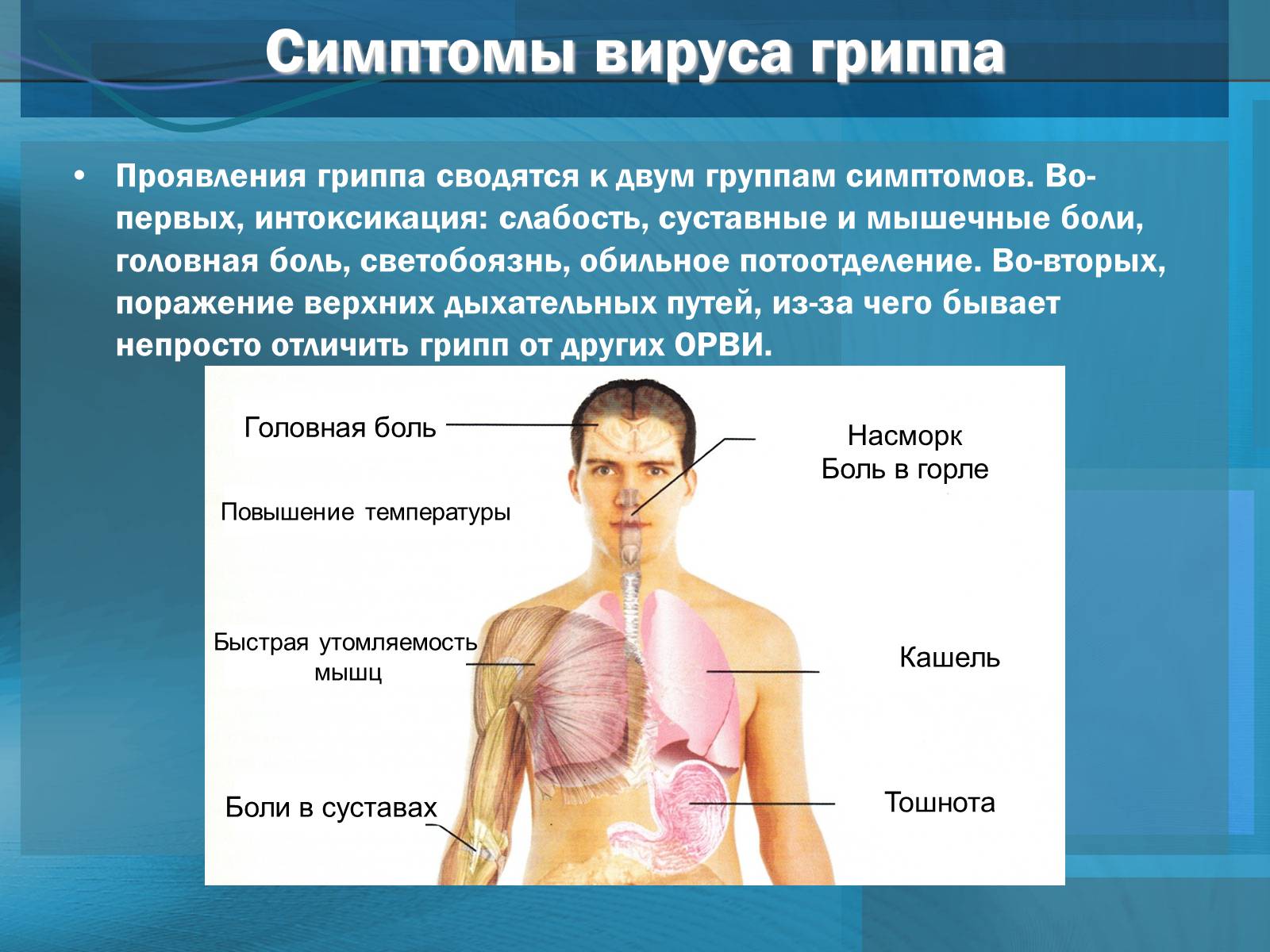 Заболевание грипп б. Симптомы гриппа. Вирус гриппа симптомы.