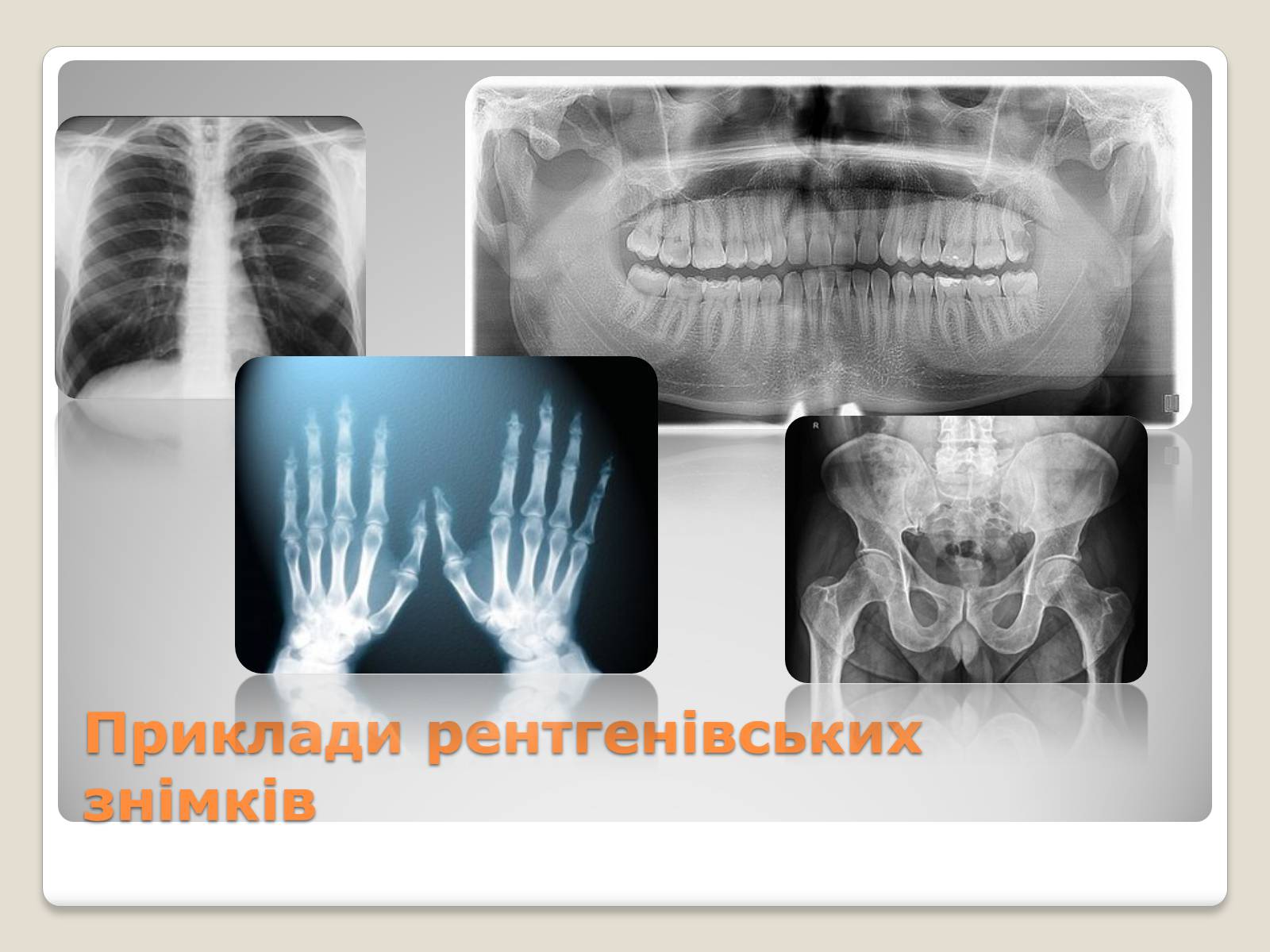 Презентація на тему «Рентгенівське випромінювання» (варіант 11) - Слайд #13