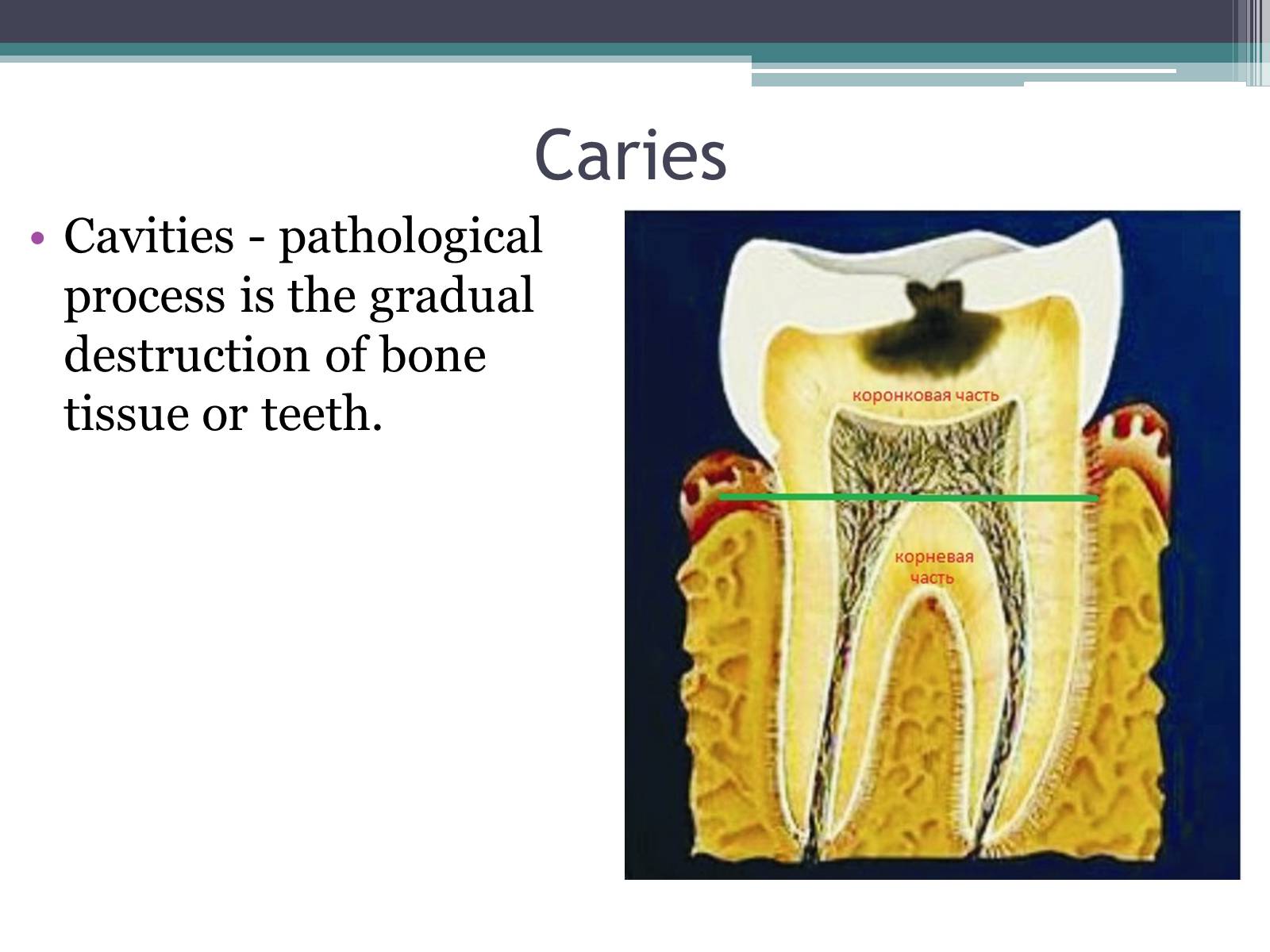 Презентація на тему «Teeth» - Слайд #8