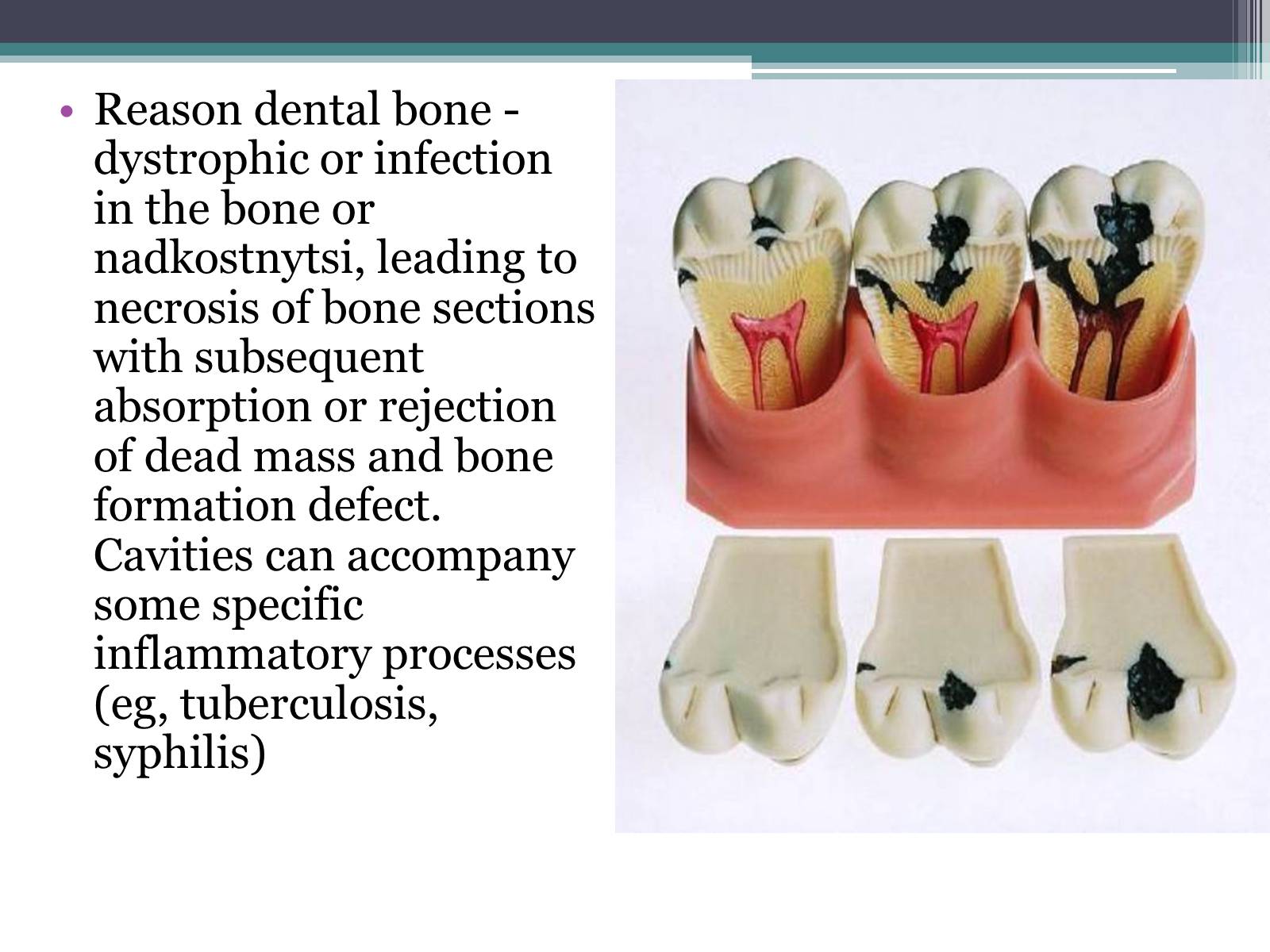 Презентація на тему «Teeth» - Слайд #9