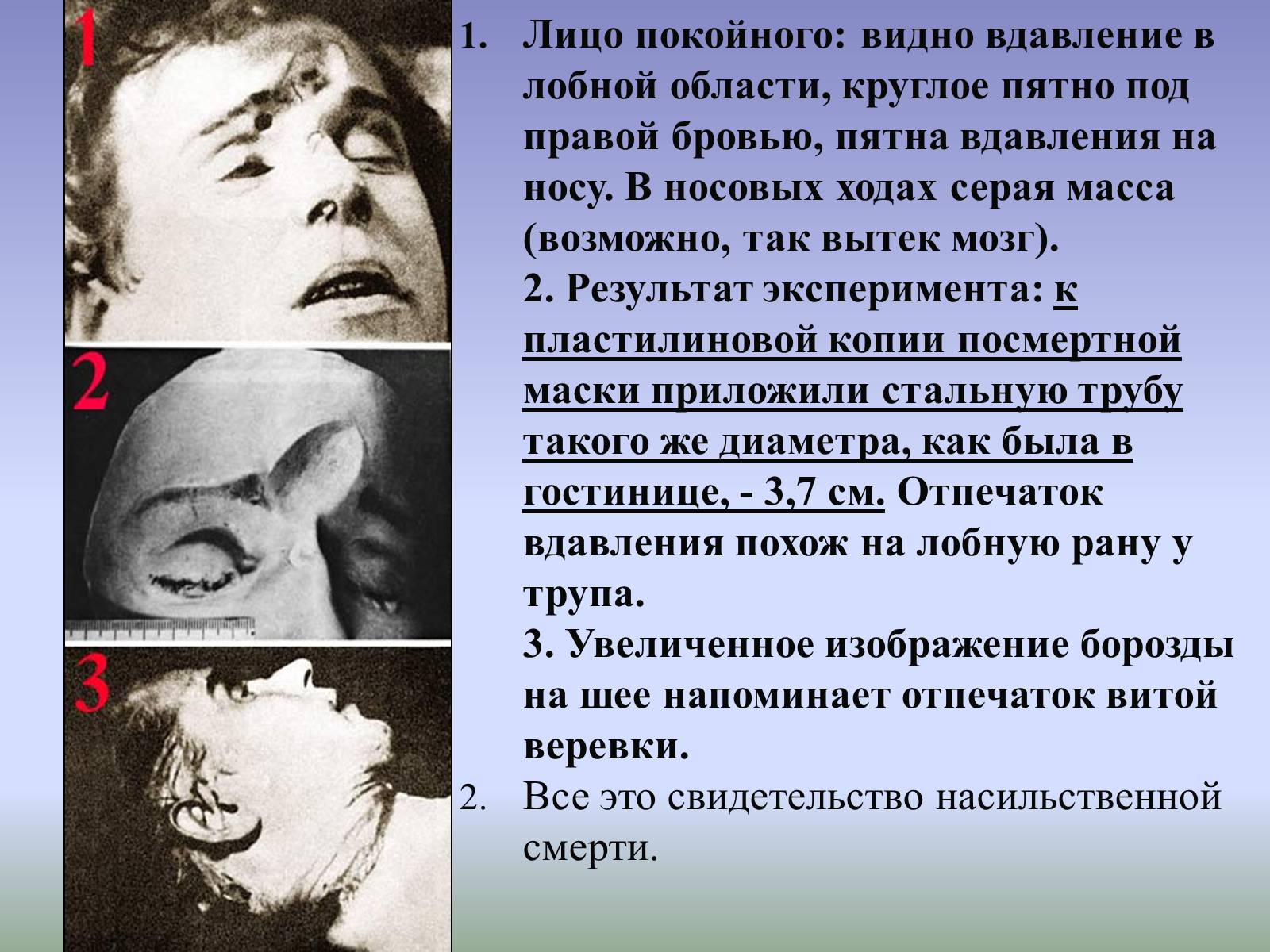 Презентація на тему «Тайна смерти Сергея Есенина» - Слайд #20