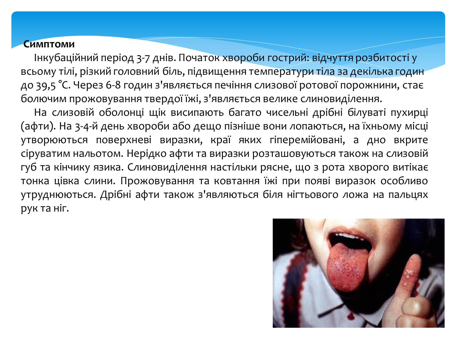 Презентація на тему «Інфекційні захворювання» (варіант 5) - Слайд #8