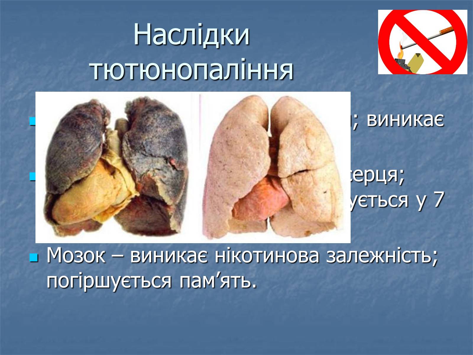 Презентація на тему «Тютюнопаління» (варіант 4) - Слайд #11