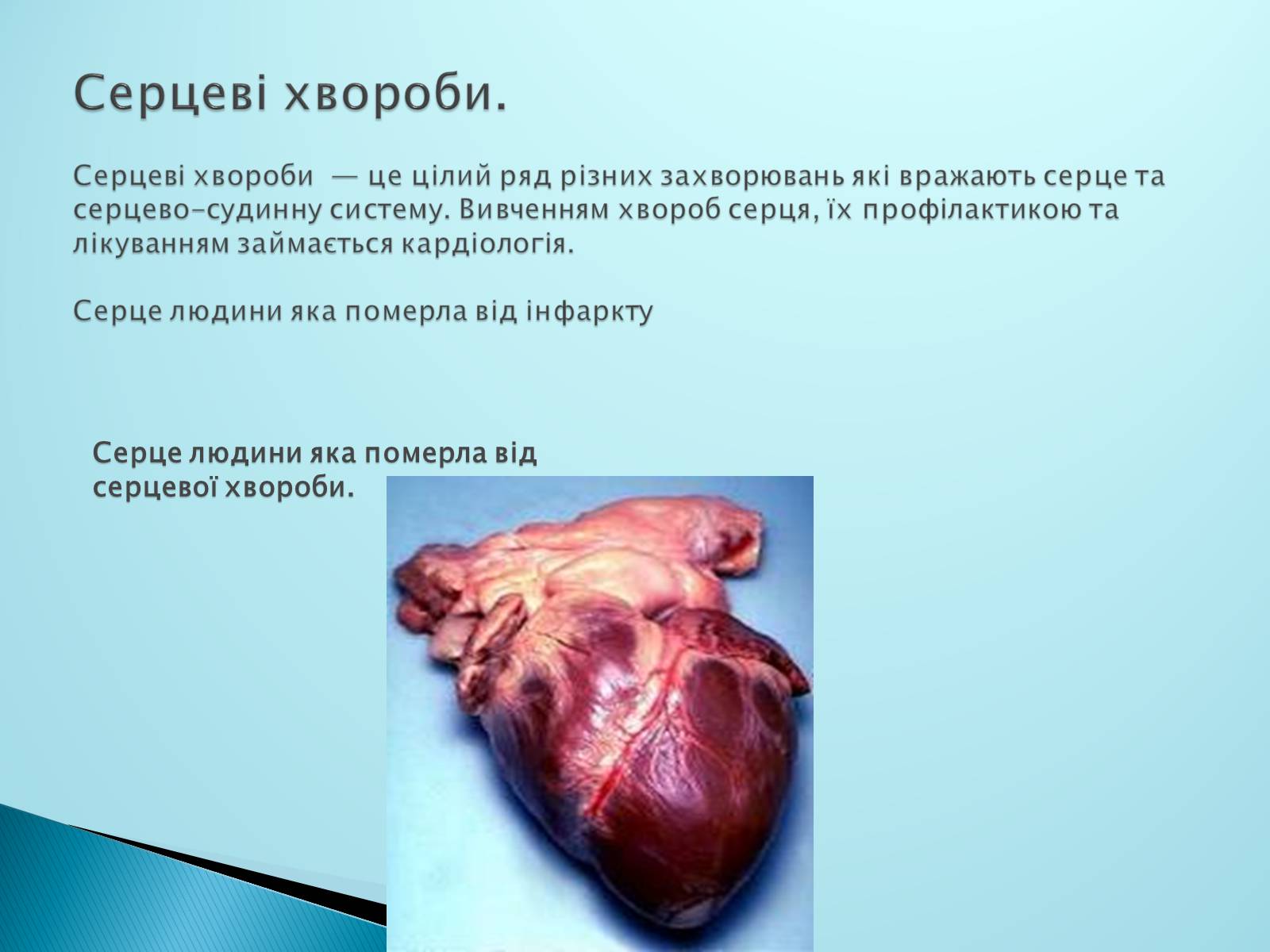 Презентація на тему «Серце. Його робота та хвороби» - Слайд #6