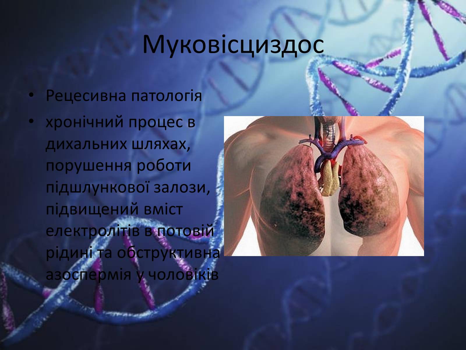 Презентація на тему «Генетичні захворювання людини» - Слайд #4