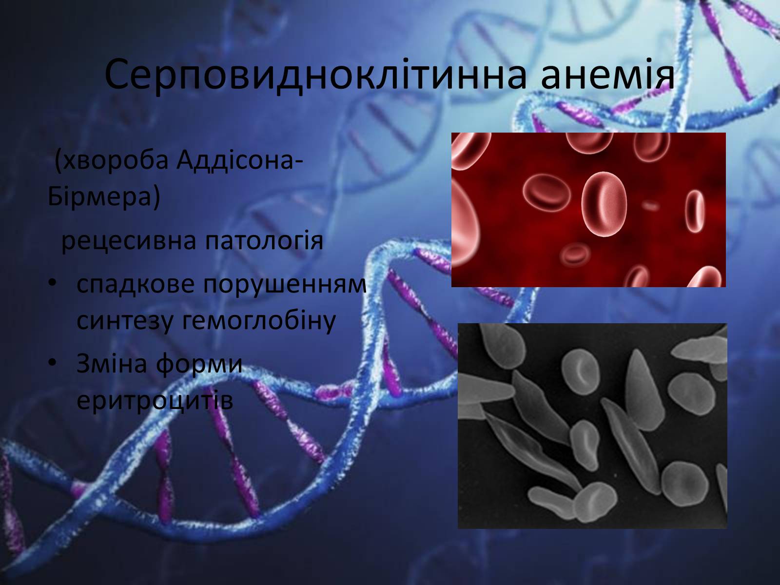 Презентація на тему «Генетичні захворювання людини» - Слайд #5