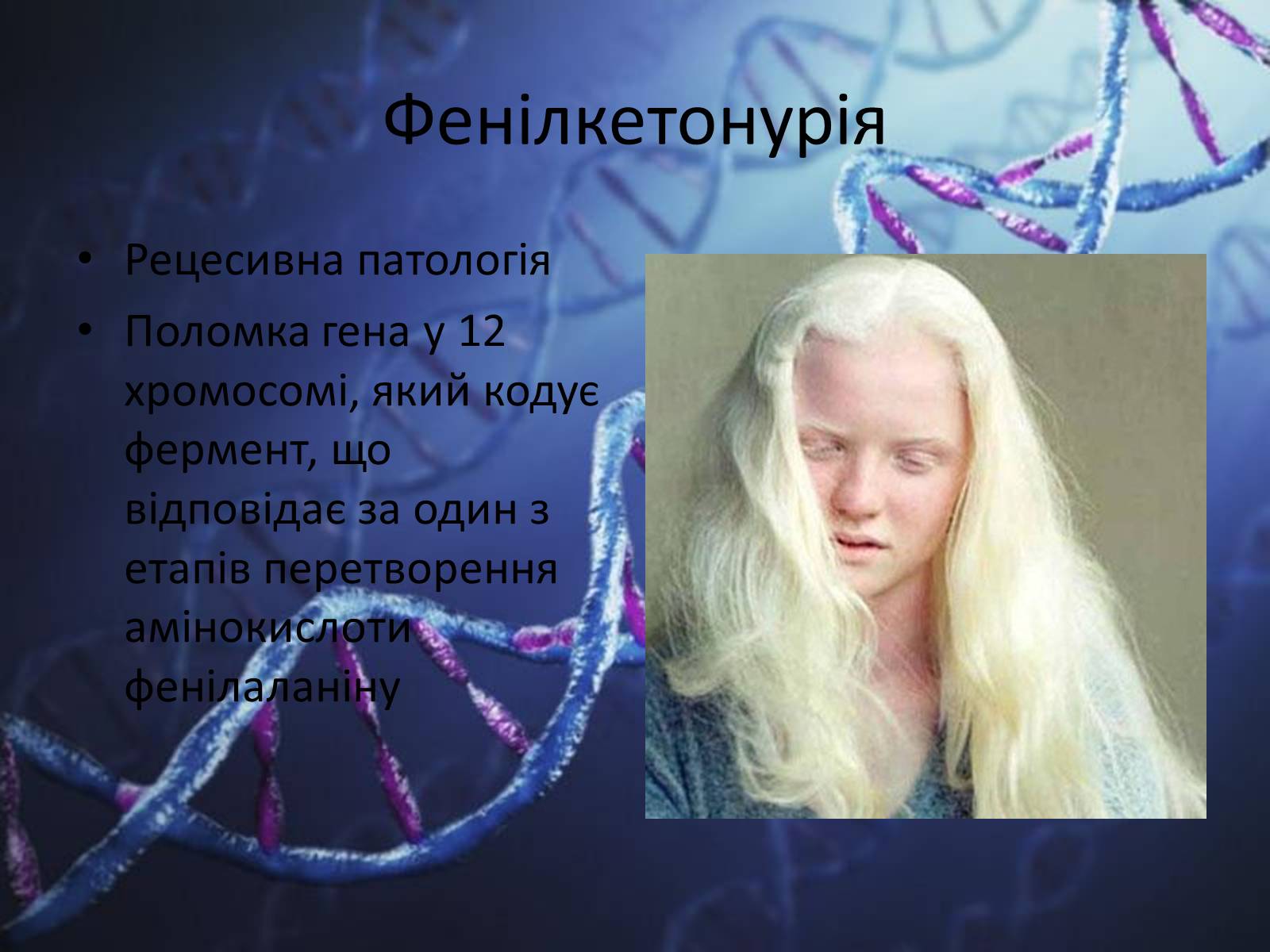 Презентація на тему «Генетичні захворювання людини» - Слайд #7