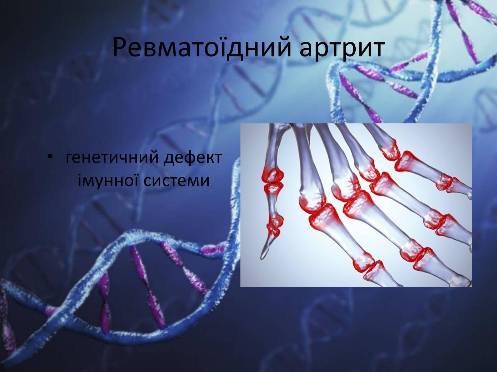 Презентація на тему «Генетичні захворювання людини» - Слайд #11