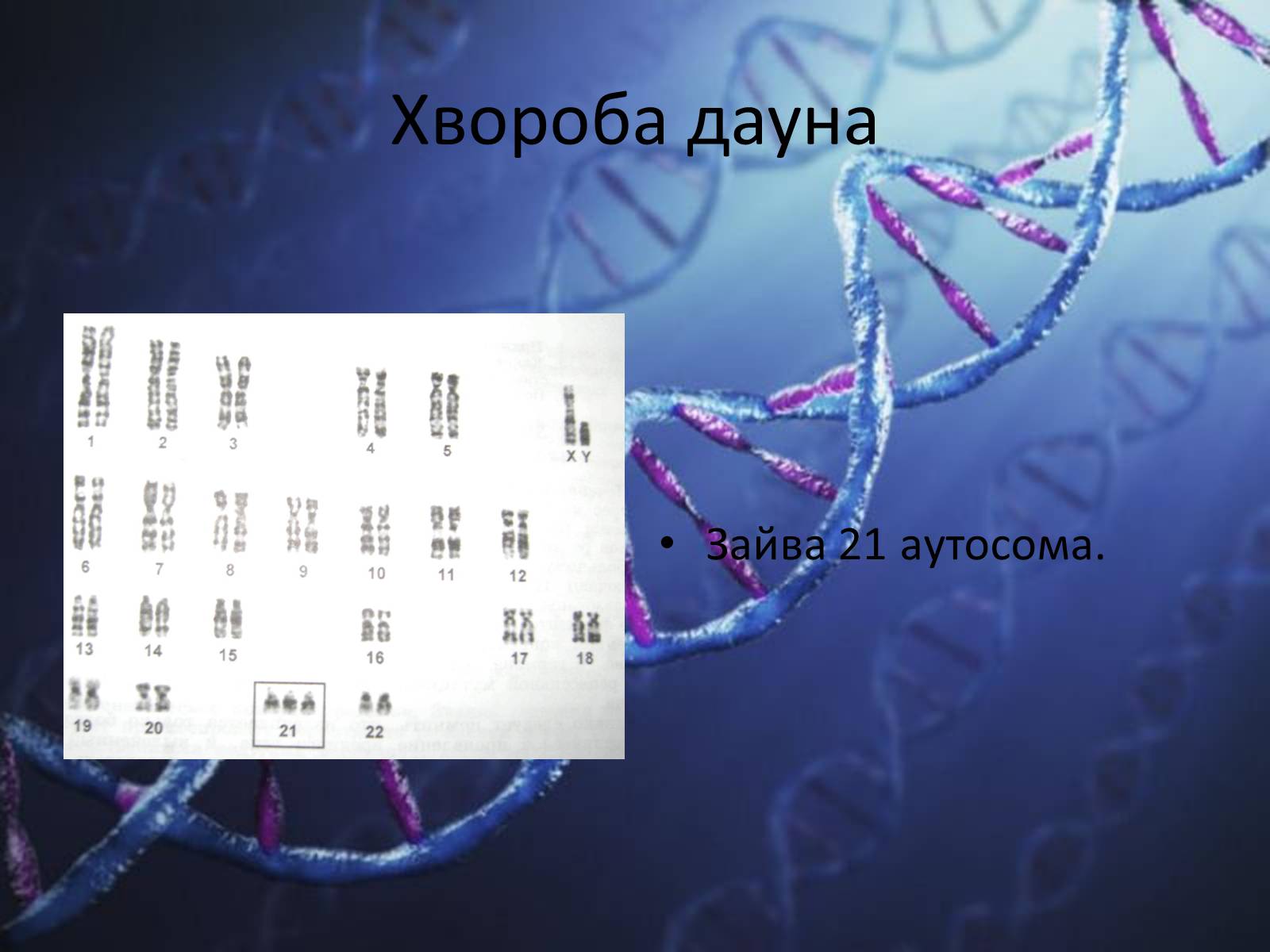 Презентація на тему «Генетичні захворювання людини» - Слайд #13