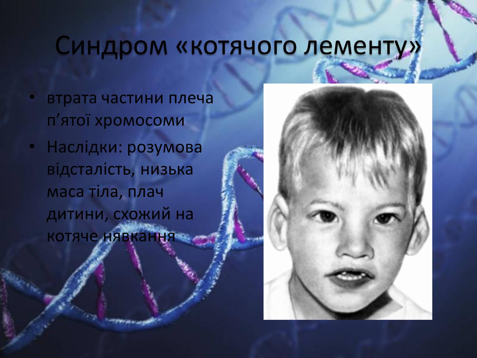 Презентація на тему «Генетичні захворювання людини» - Слайд #14