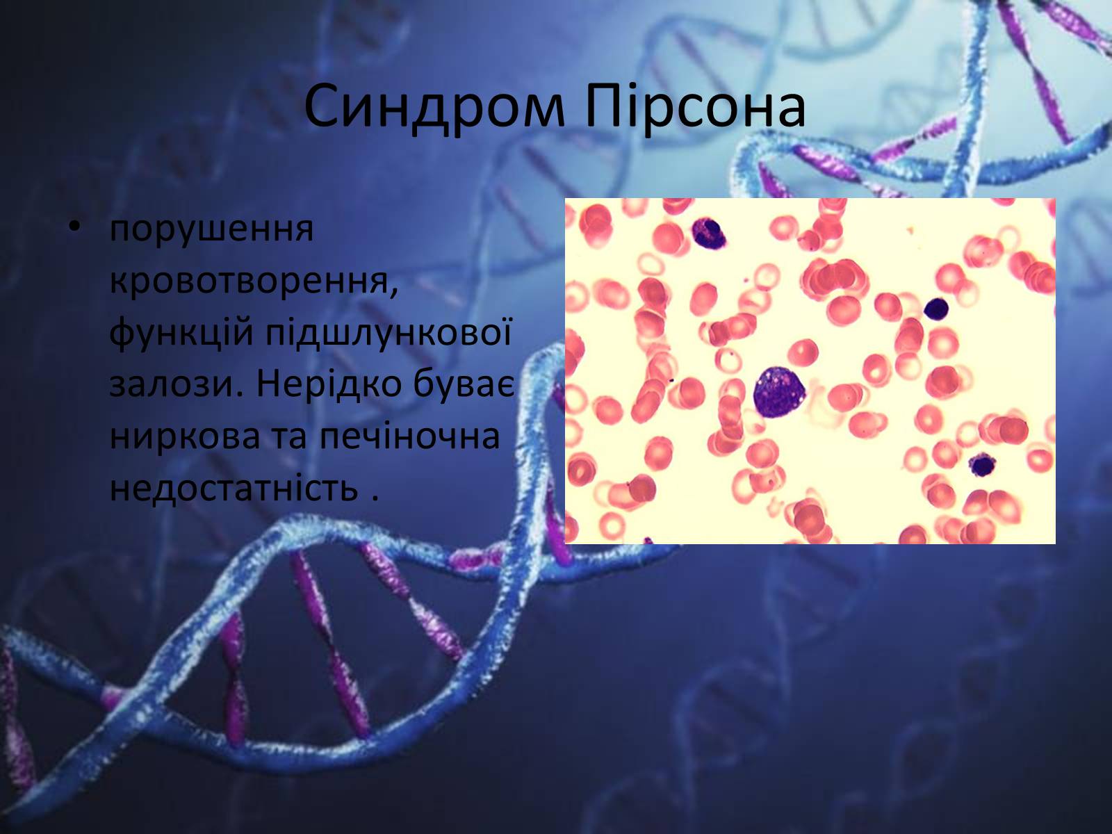 Презентація на тему «Генетичні захворювання людини» - Слайд #16
