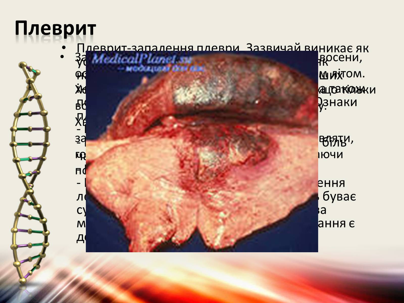 Презентація на тему «Захворювання дихальної системи» (варіант 1) - Слайд #19